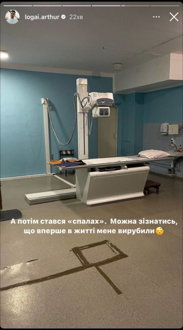 Український актор Артур Логай потрапив до лікарні зі струсом мозку