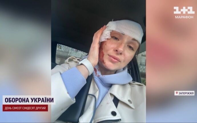 Прилет по Запорожью: есть пострадавшие, среди которых двое журналистов (фото, видео)