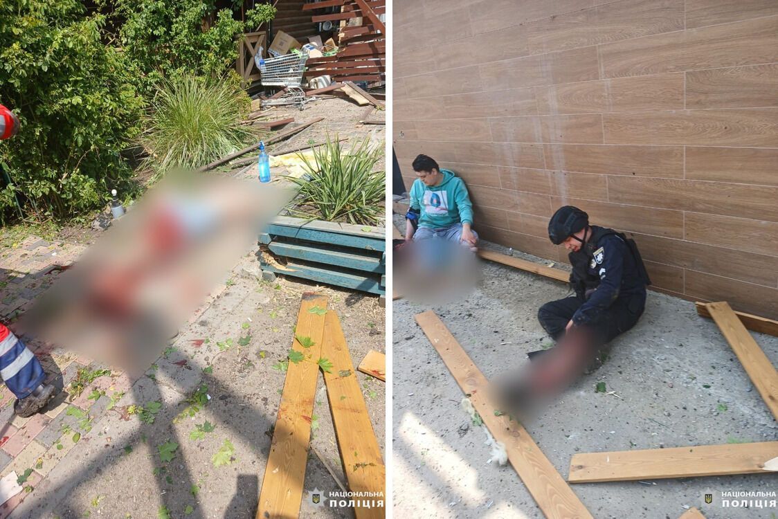 Працівника поліції пораненого в ногу