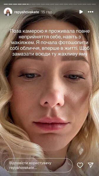 Репьяхова снова легла под нож: последствия операции