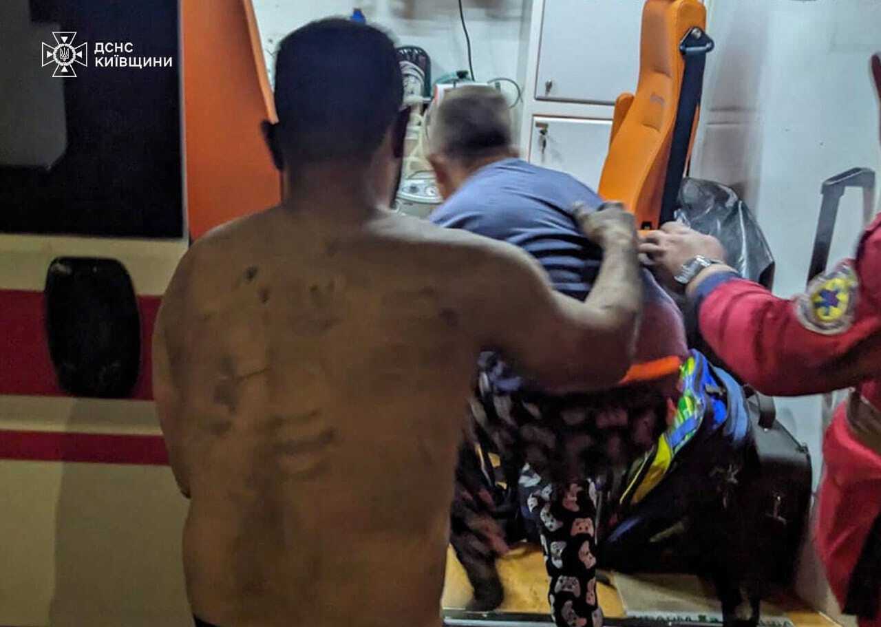 На Київщині вибухнув зарядний пристрій: постраждала родина з двома дітьми