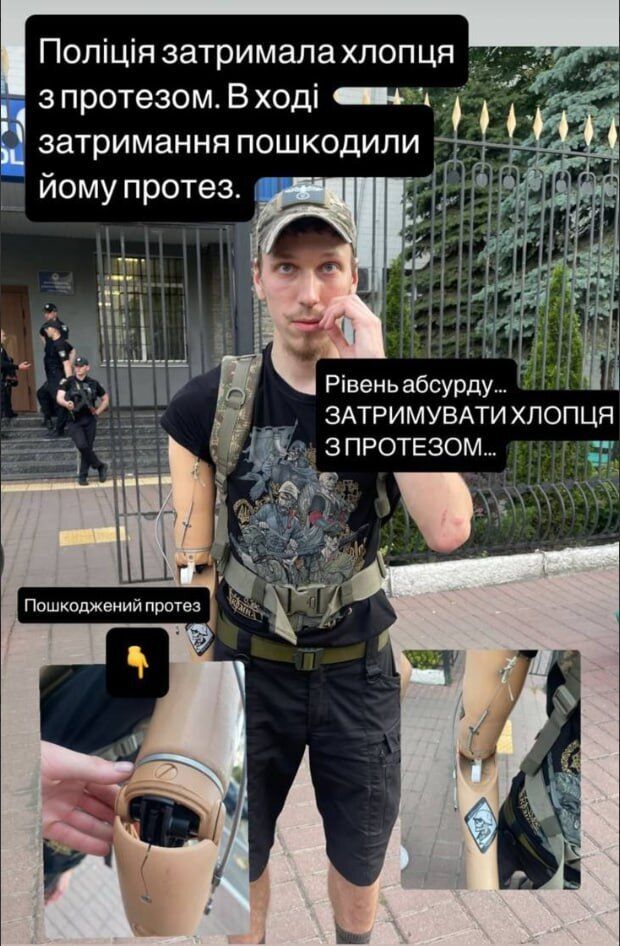Після сутичок на ''КиївПрайді'' поліція звинуватила ветерана з протезом у травмуванні силовика