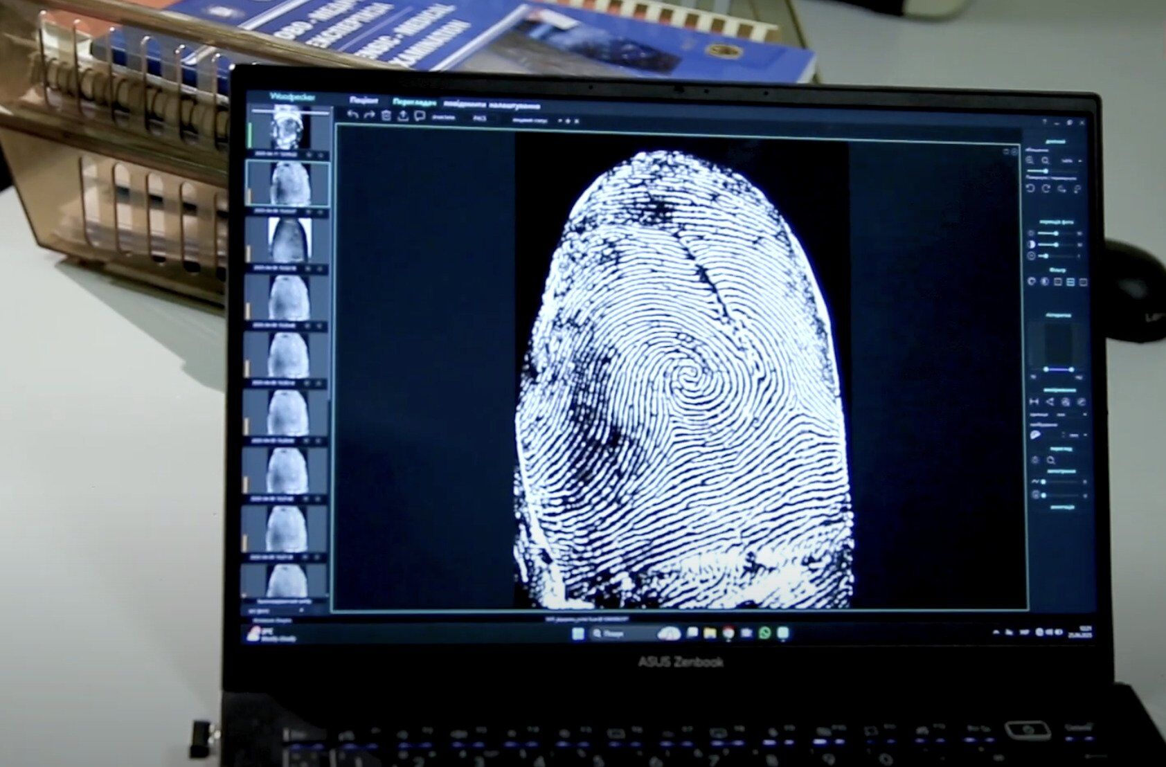 Відбиток пальця загиблого військовослужбовця. На судмедекспертизу тіло поступило муміфікованим, що ускладнювало подальшу ідентифікацію. Та відновити відбитки пальців вдалось завдяки методу, який запатентували вінницькі експерти