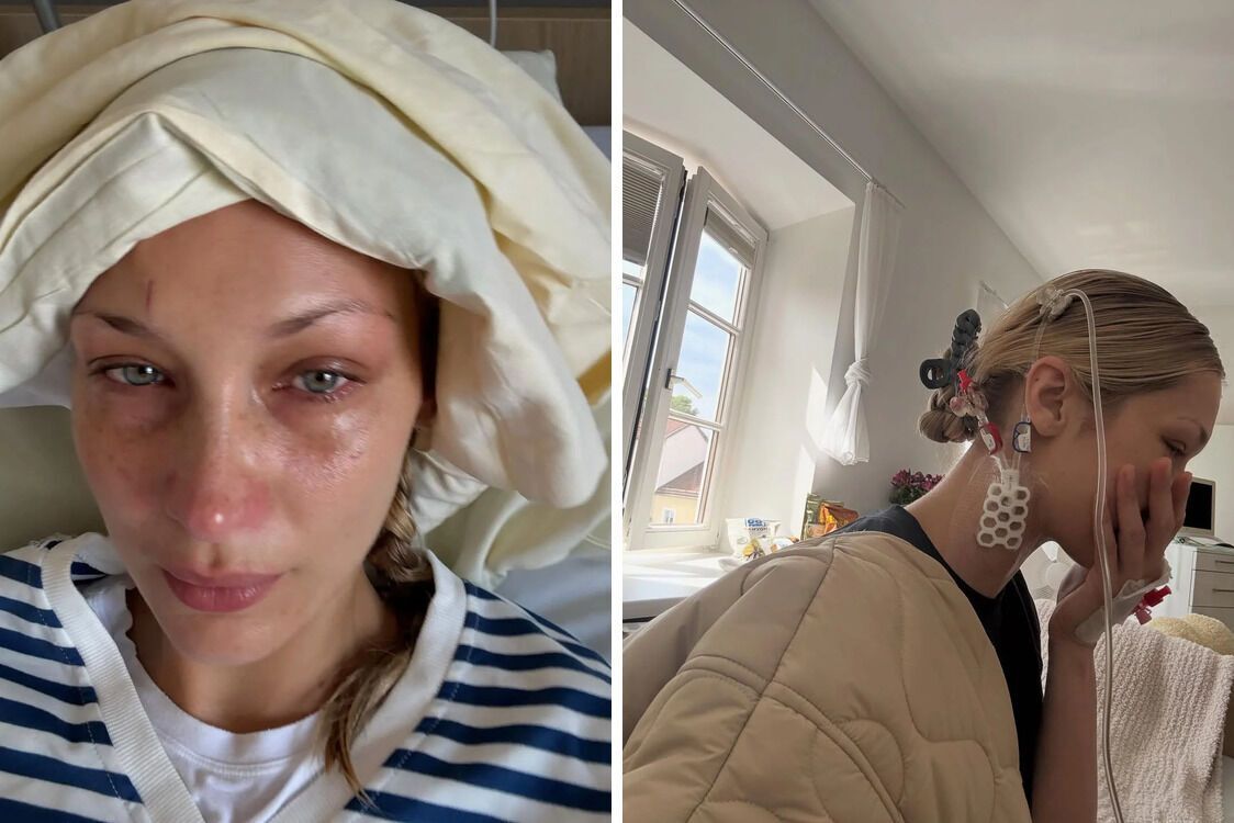 Як Белла Хадід бореться з хронічною недугою