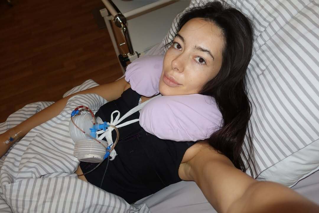 Відома столична блогерка видалила імпланти і зізналась, чому пішла на такий крок 