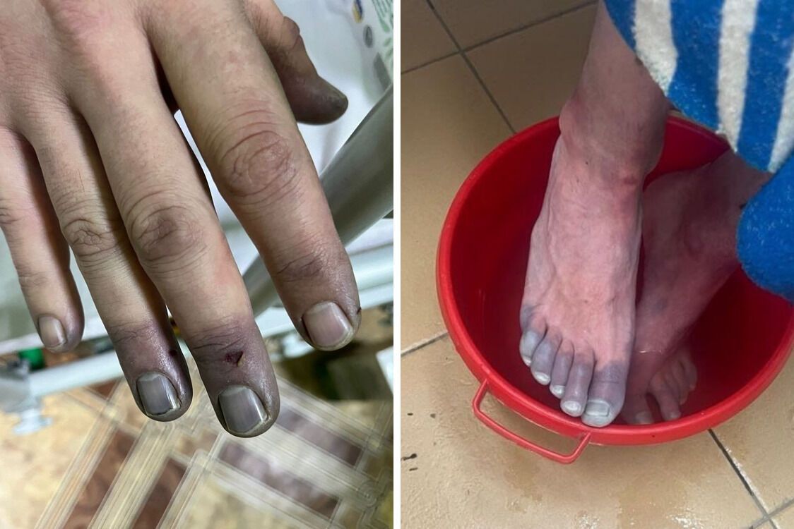 Пограничники спасли двух мужчин, потерявшихся в лесу при -20°