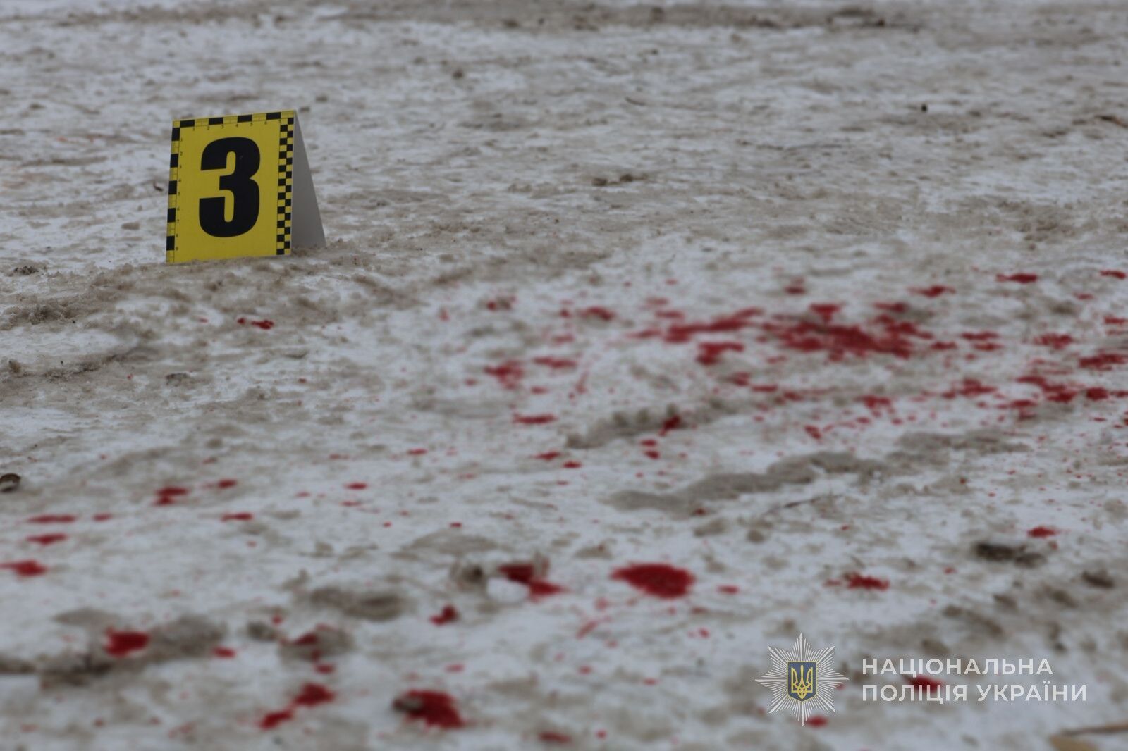 В Запорожье 16-летний парень травмировал себя во время стрельбы во дворе