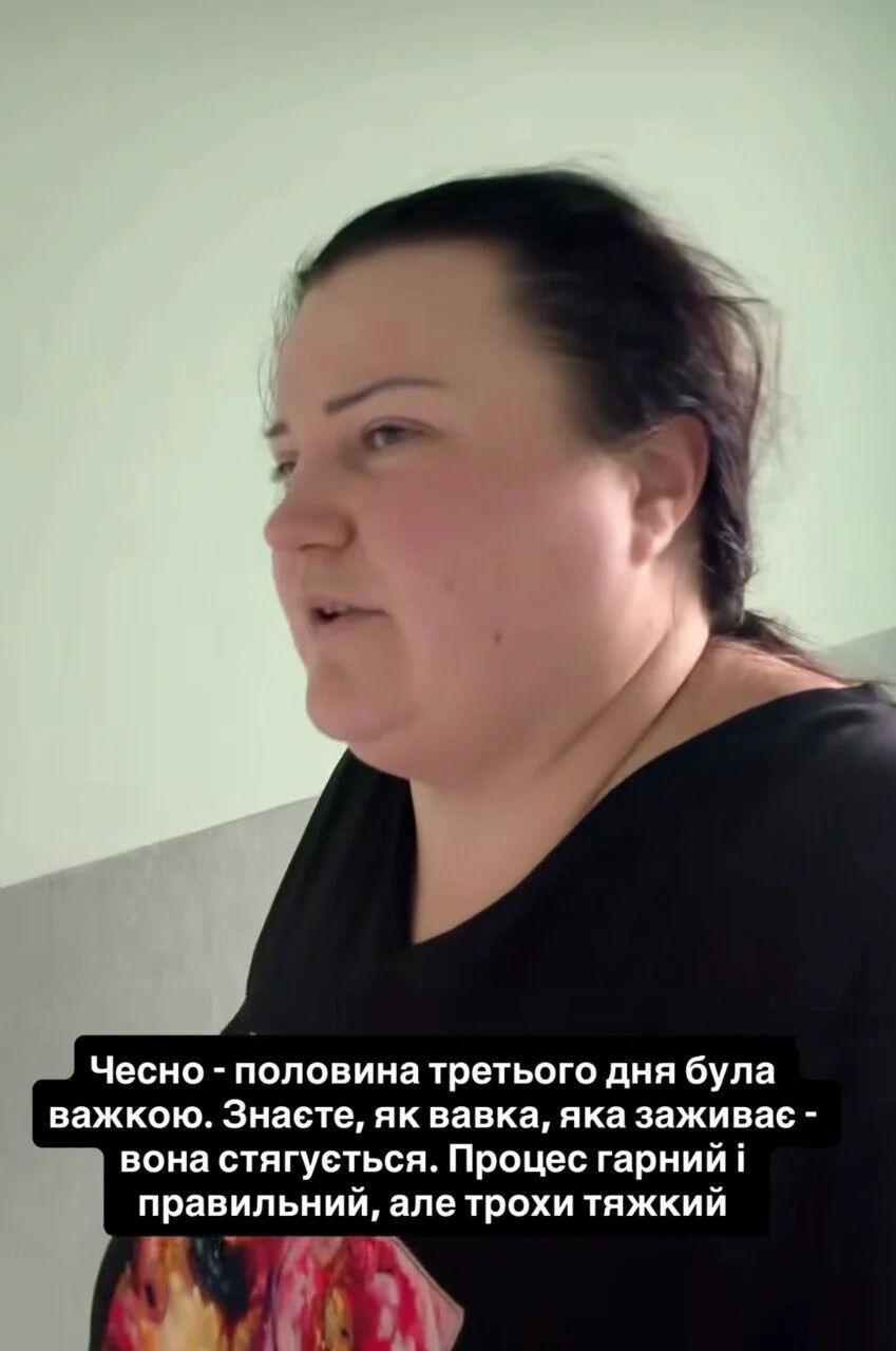 alyona alyona розповіла про труднощі після операції зі зменшення шлунка