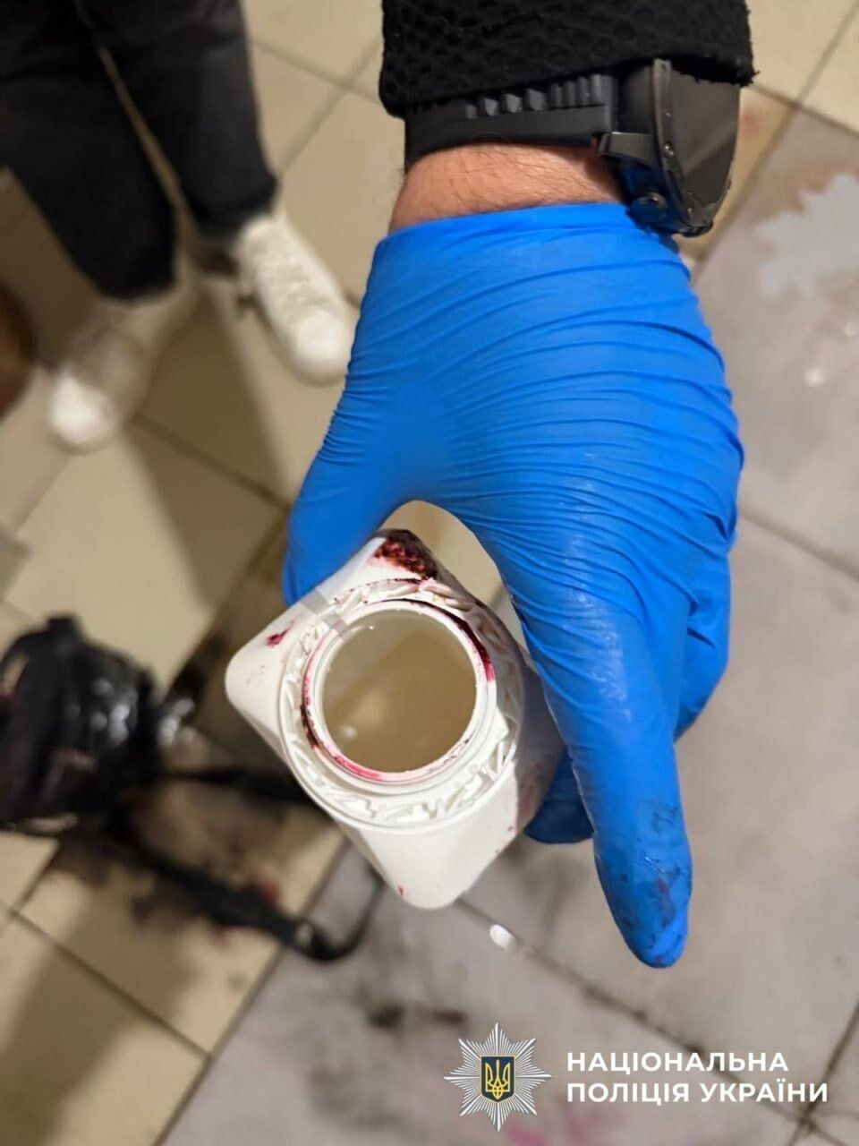 На Київщині зірвали замовний напад із кислотою на жінку: затримано трьох чоловіків
