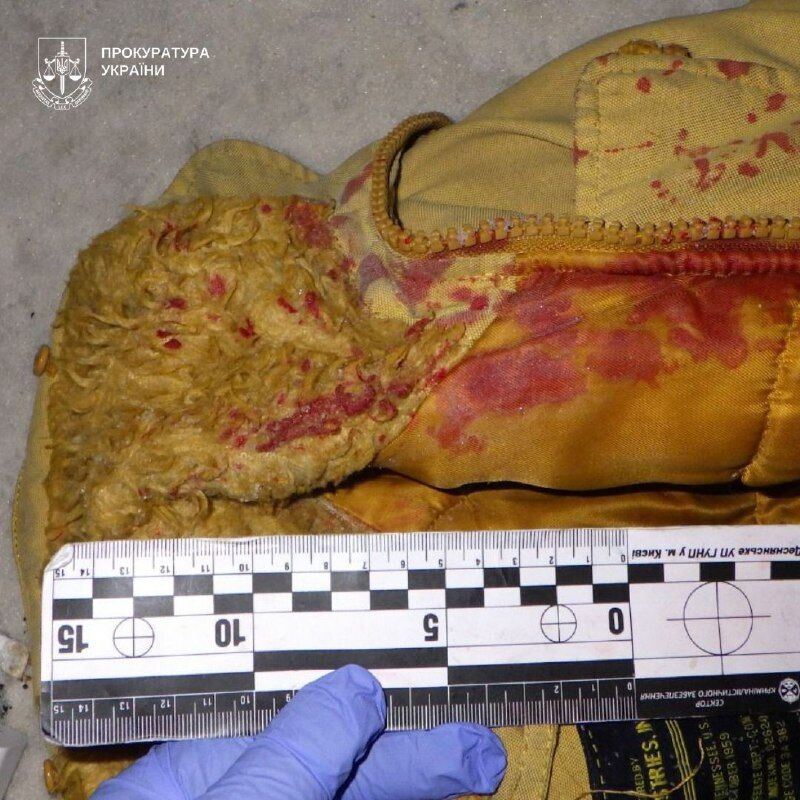 У Києві чоловік канцелярським ножем понівечив обличчя 17-річного підлітка