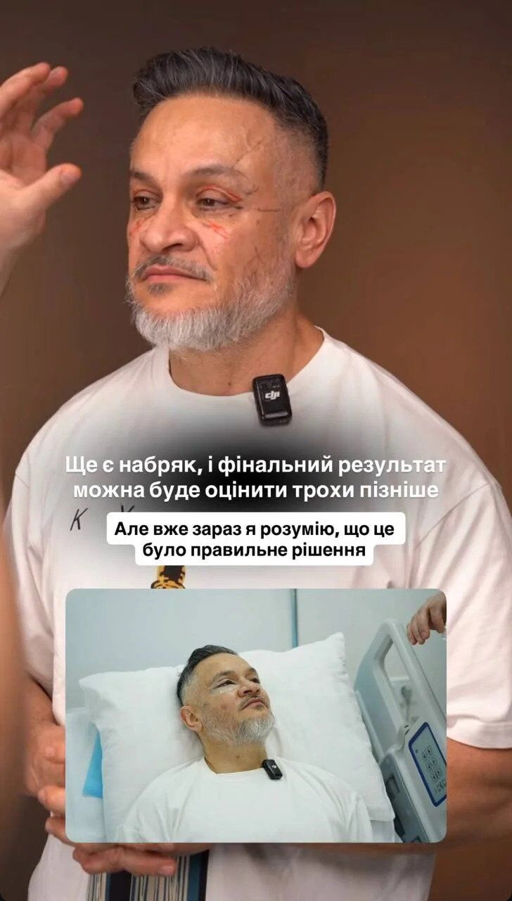 Эктор Хименес-Браво открыто рассказал об изменении внешности