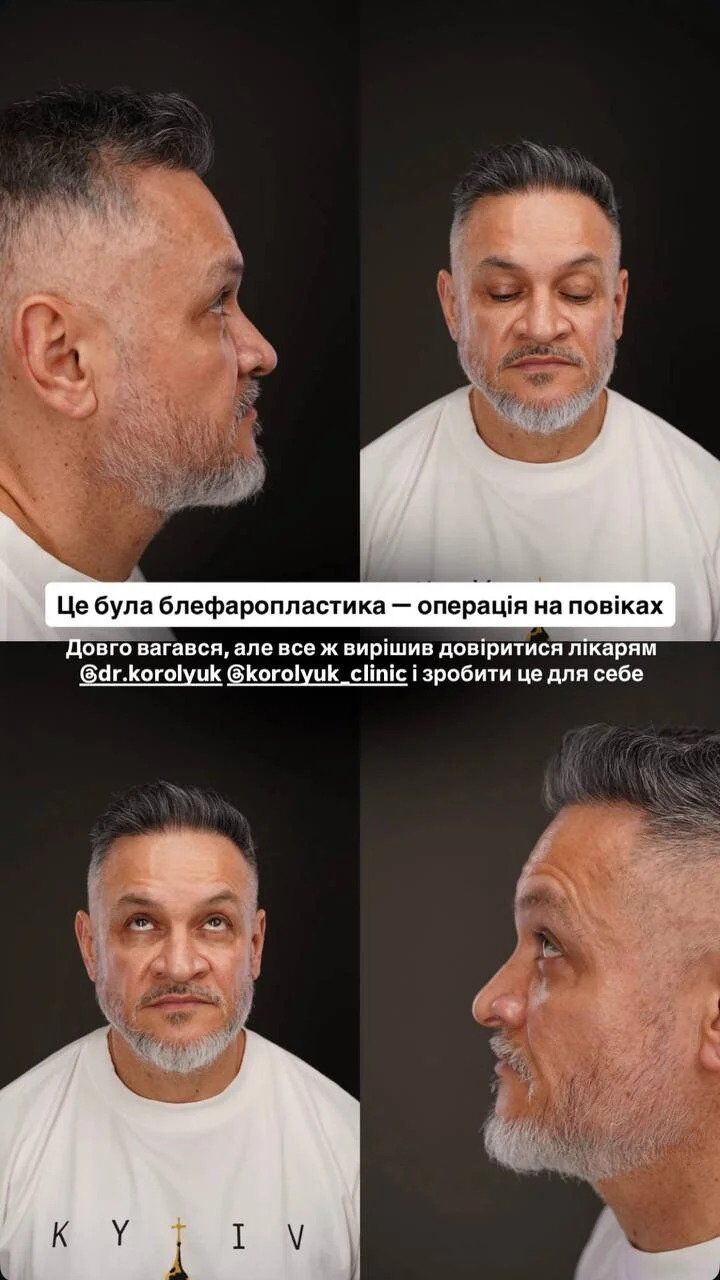 Эктор Хименес-Браво открыто рассказал об изменении внешности