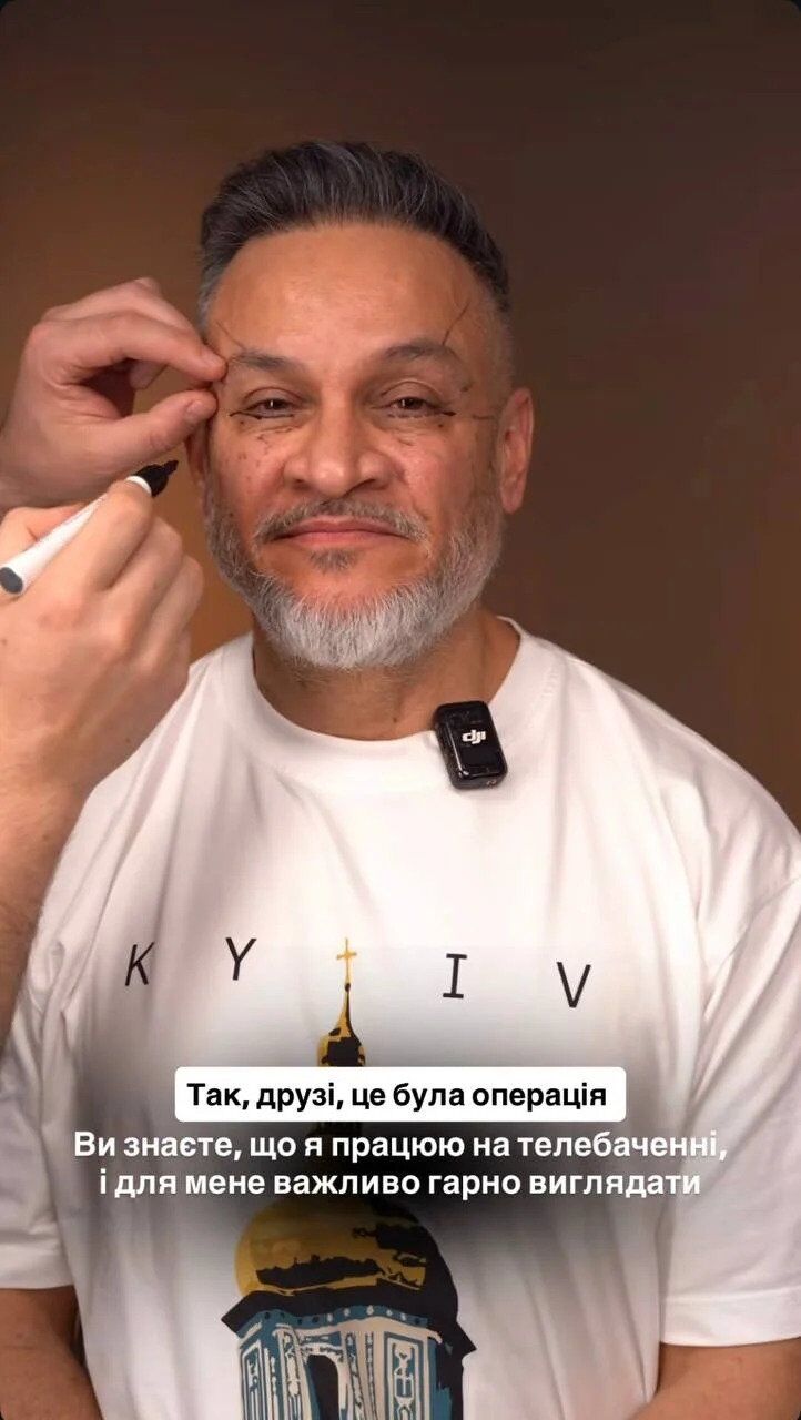 Эктор Хименес-Браво открыто рассказал об изменении внешности