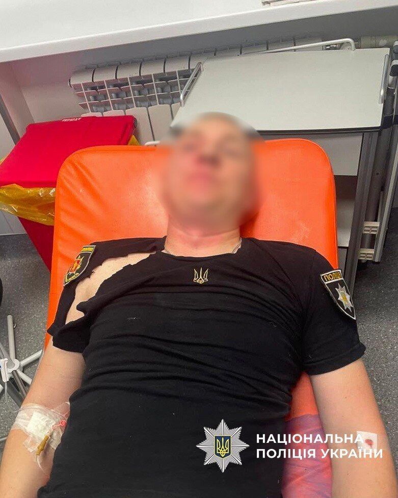 У Запоріжжі чоловік атакував поліцейських газом і ножем: що відомо про інцидент