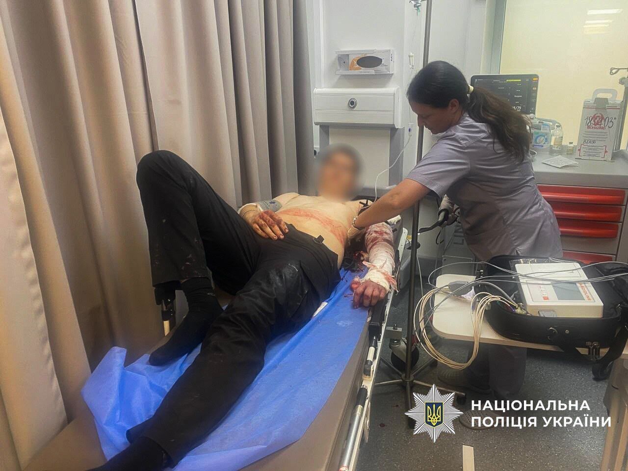 У Запоріжжі чоловік атакував поліцейських газом і ножем: що відомо про інцидент