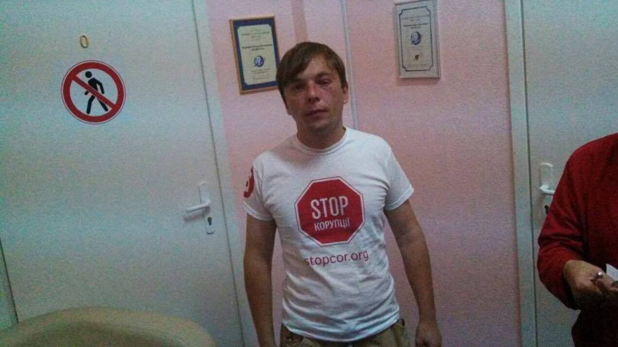 У мережі з'явилося відео нападу на журналіста 'СтопКору' Сергія Медяника
