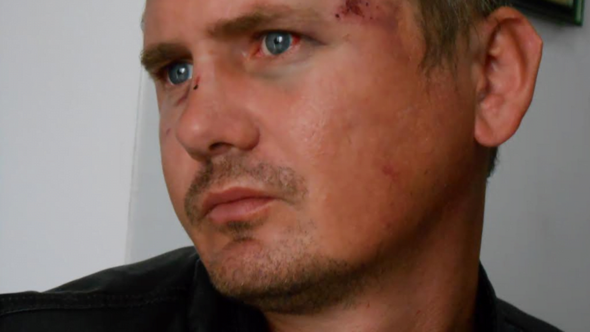З'явились фото активіста 'Стоп корупції' Ярослава Лемиша після нападу на нього депутата з Миколаївщини