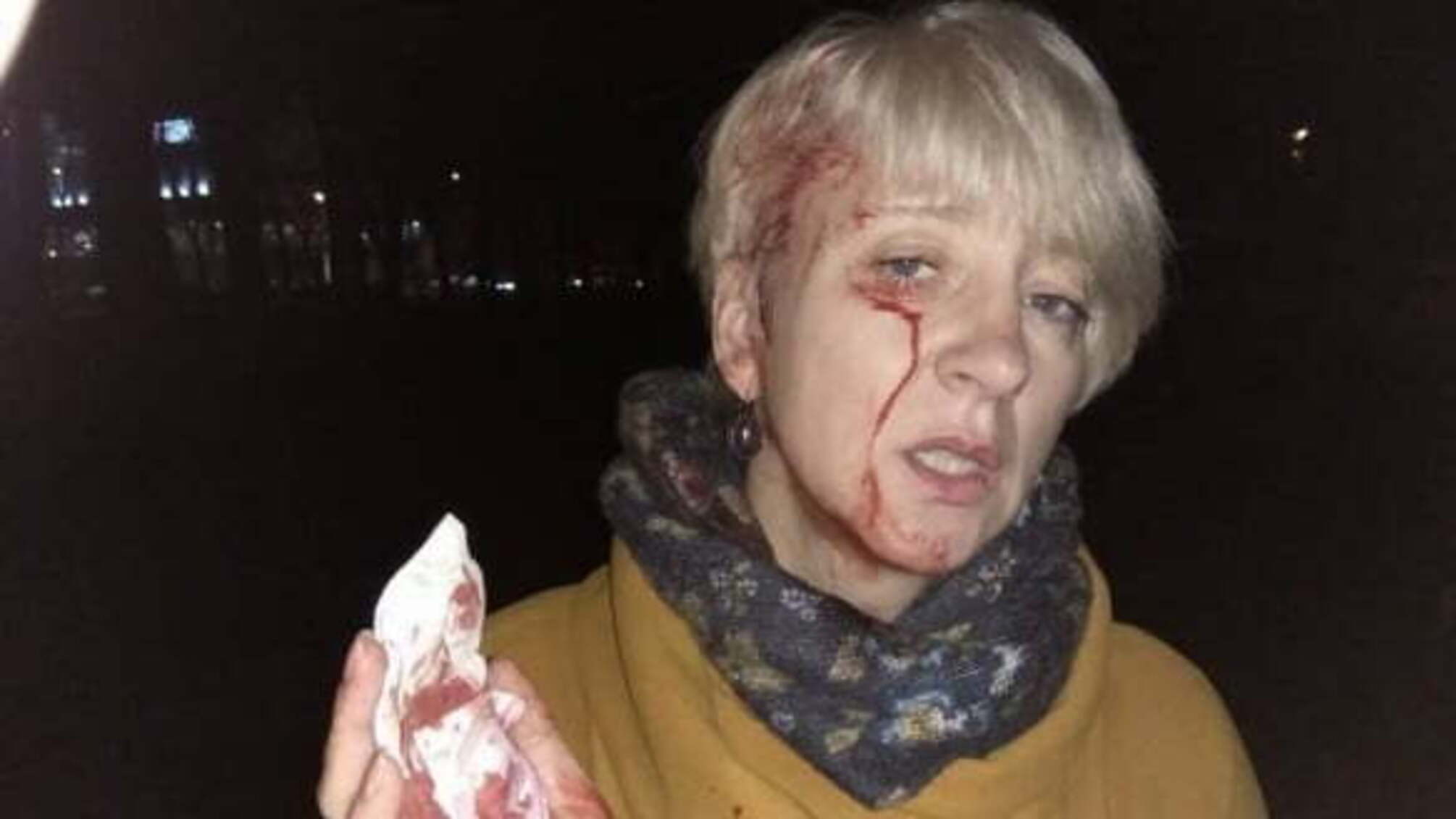 Поліція почала розслідування за фактом нападу на суддю у Полтаві