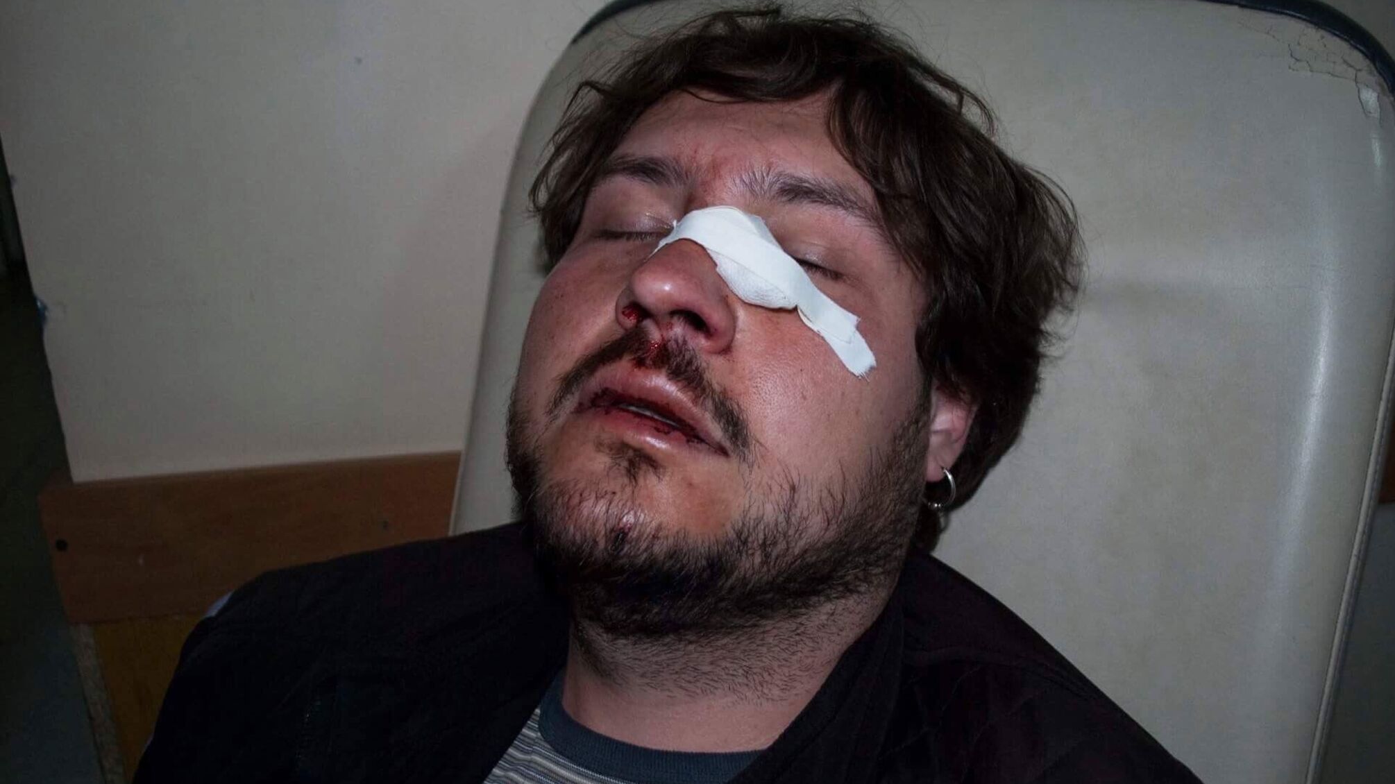 У лікарняну палату до журналіста 'СтопКору' з Марганця 'підселили' брата скандального депутата Бондаренка