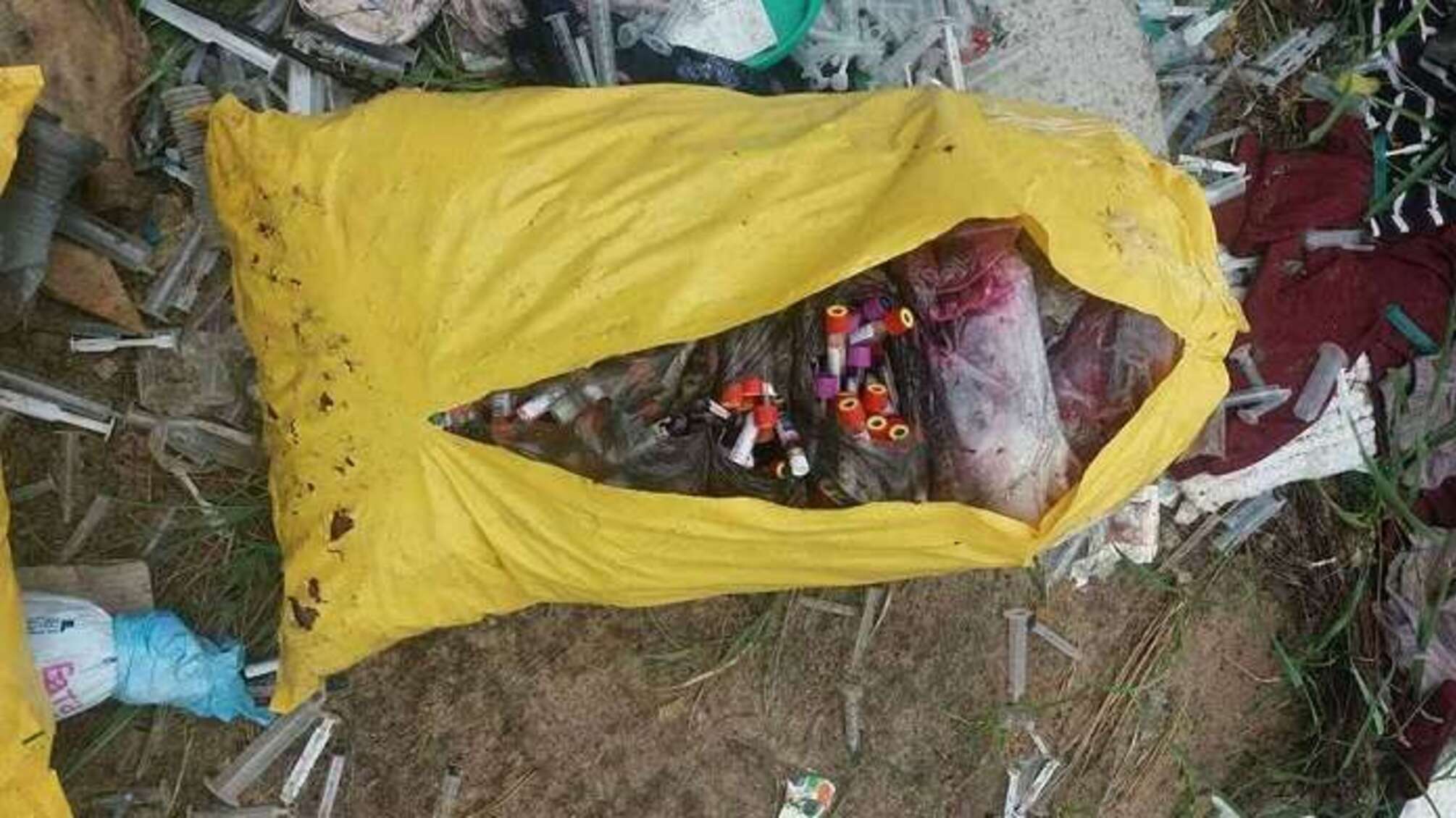 Моторошна знахідка: на Київщині виявили незаконне звалище з хірургічними відходами органічного та неорганічного походження