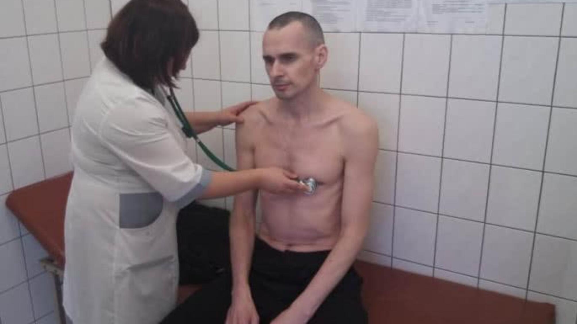У мережі з'явилося фото Олега Сенцова після голодування