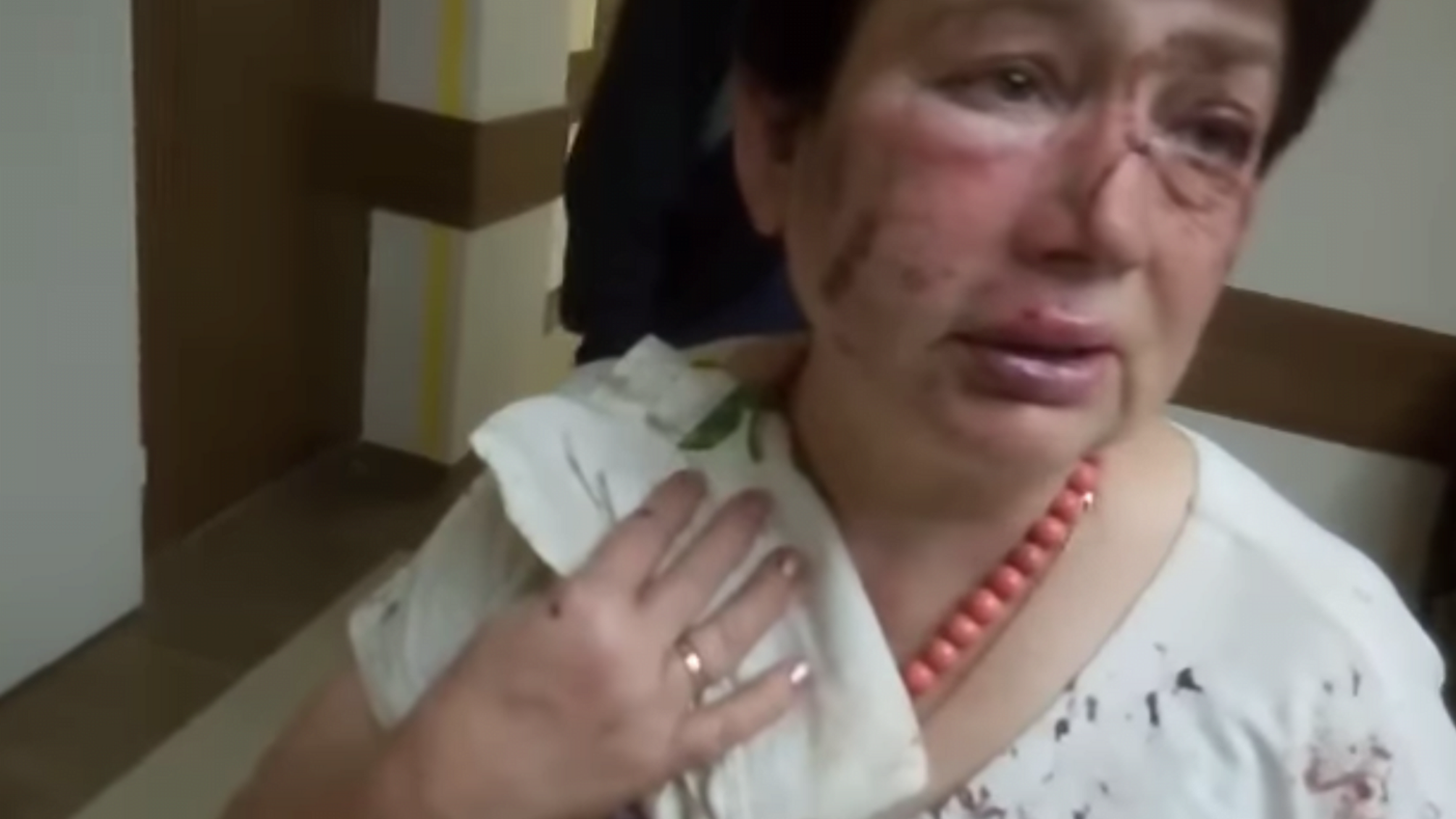 Як за 1000 гривень жорстоко побили пенсіонерку та до чого тут Біличанський ліс