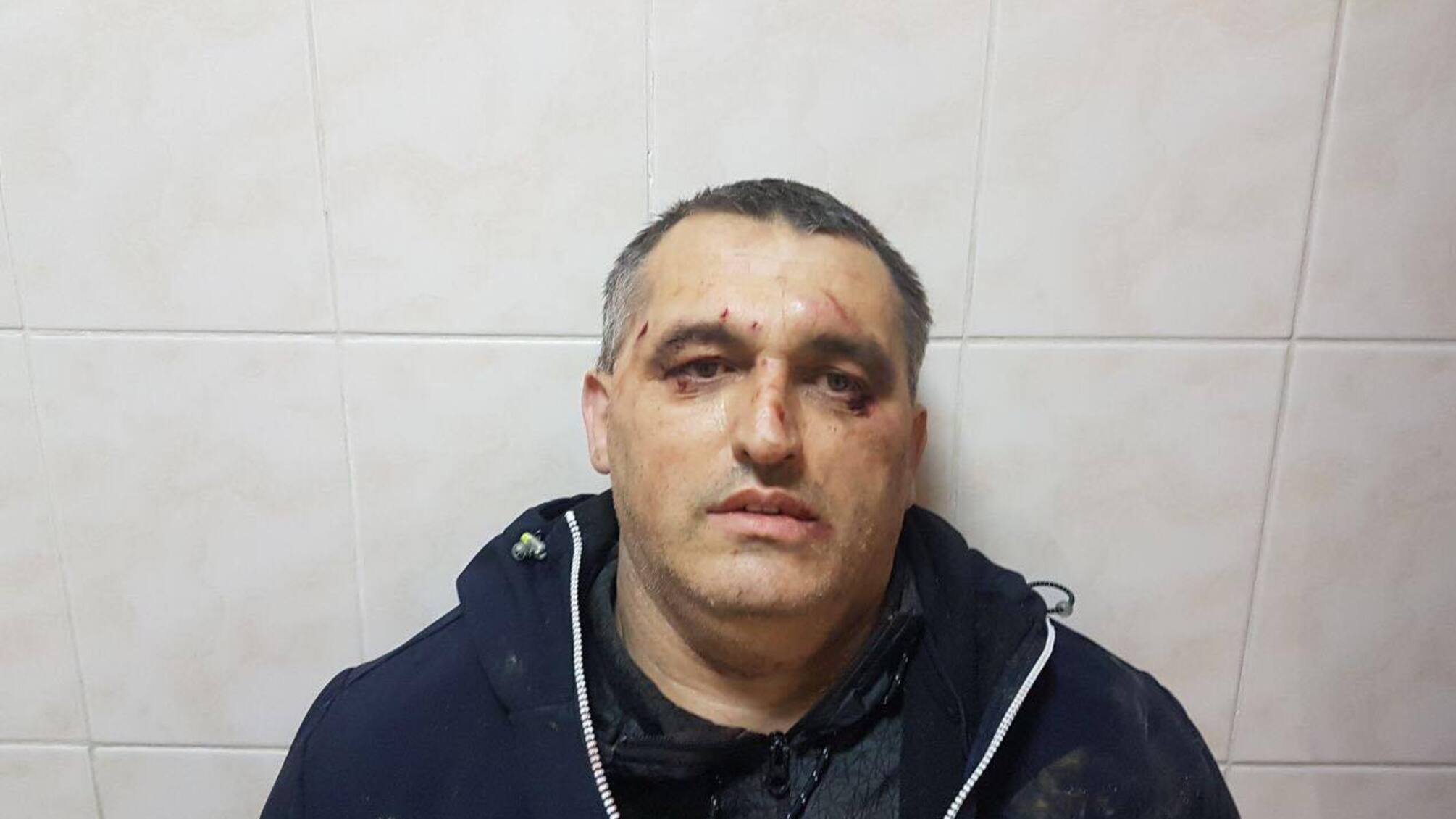 Журналісти дізналися, хто стоїть за кривавою розправою над чернівецькими активістами 'СтопКору'