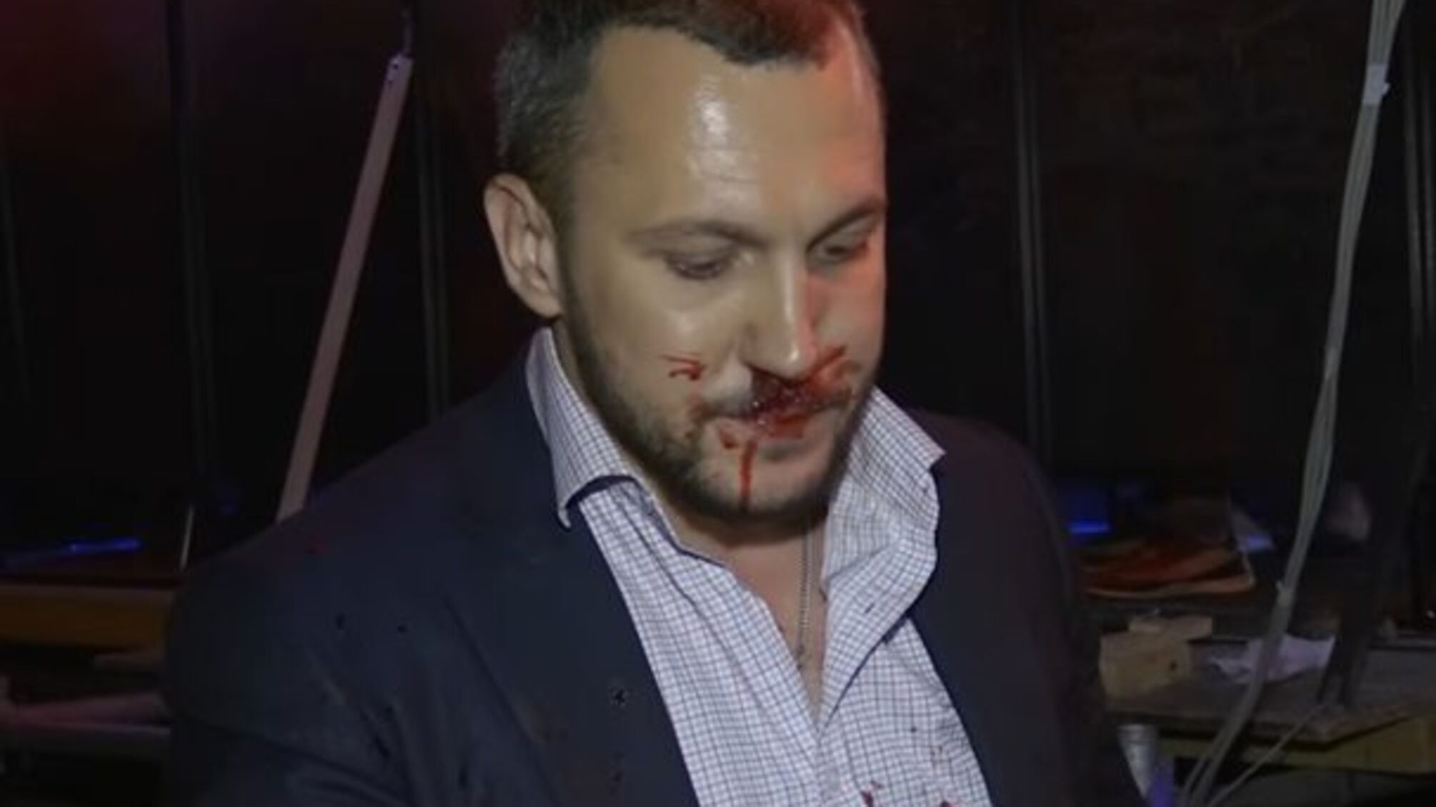 Двоє нардепів-радикалів побилися після ефіру на одному з каналів