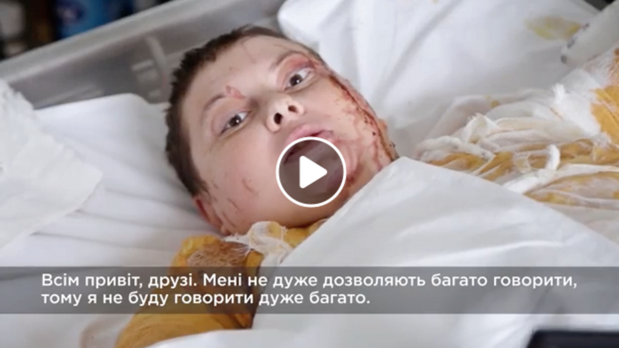 “Хто замовив 40 нападів? Хто покриває замовників?” - відеозвернення покаліченої Гандзюк пробирає до кісток (ВІДЕО)