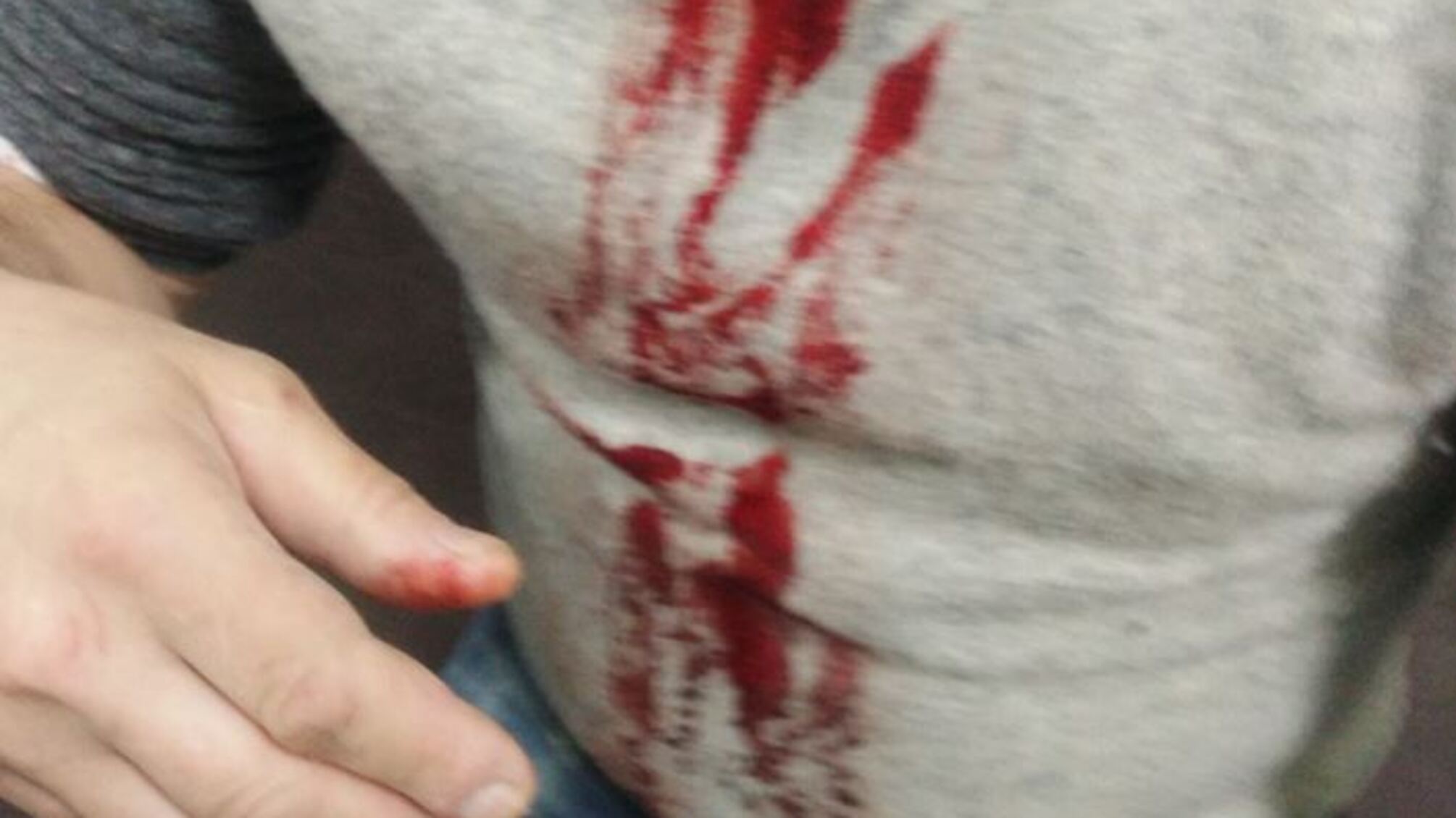 Біля одного зі столичних університетів перехожого поранили ножем в шию (ФОТО 18+)