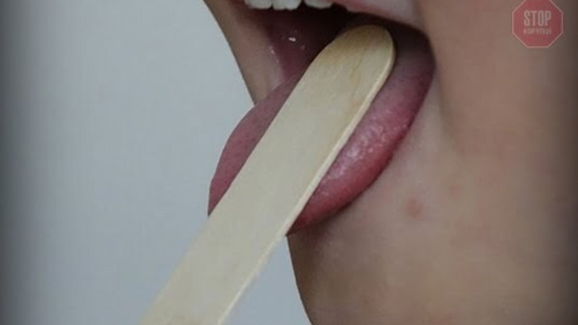 Дифтерія в Києві: чого чекати?