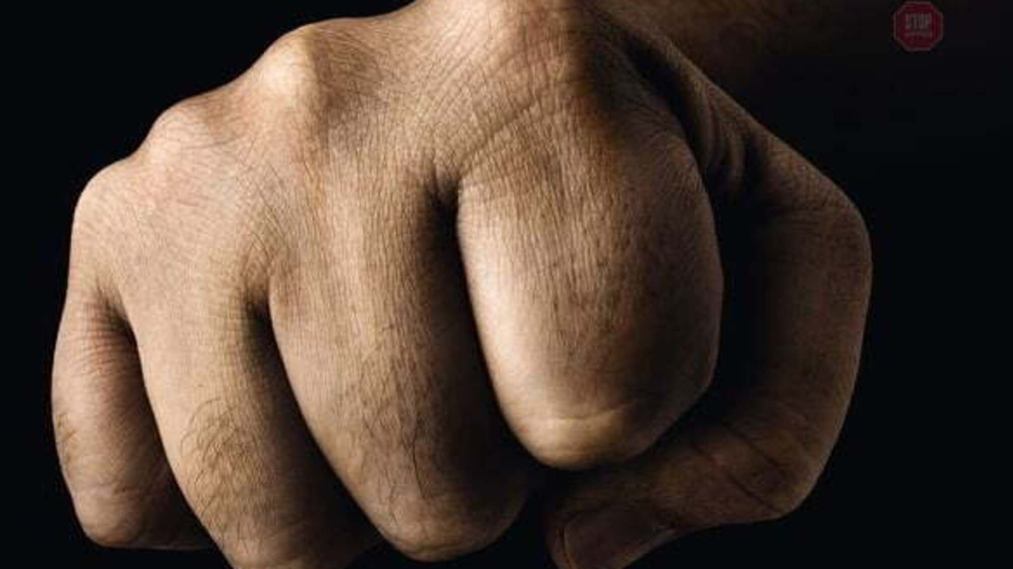 Підбіг та почав бити: у Полтаві напали на поліціянтку