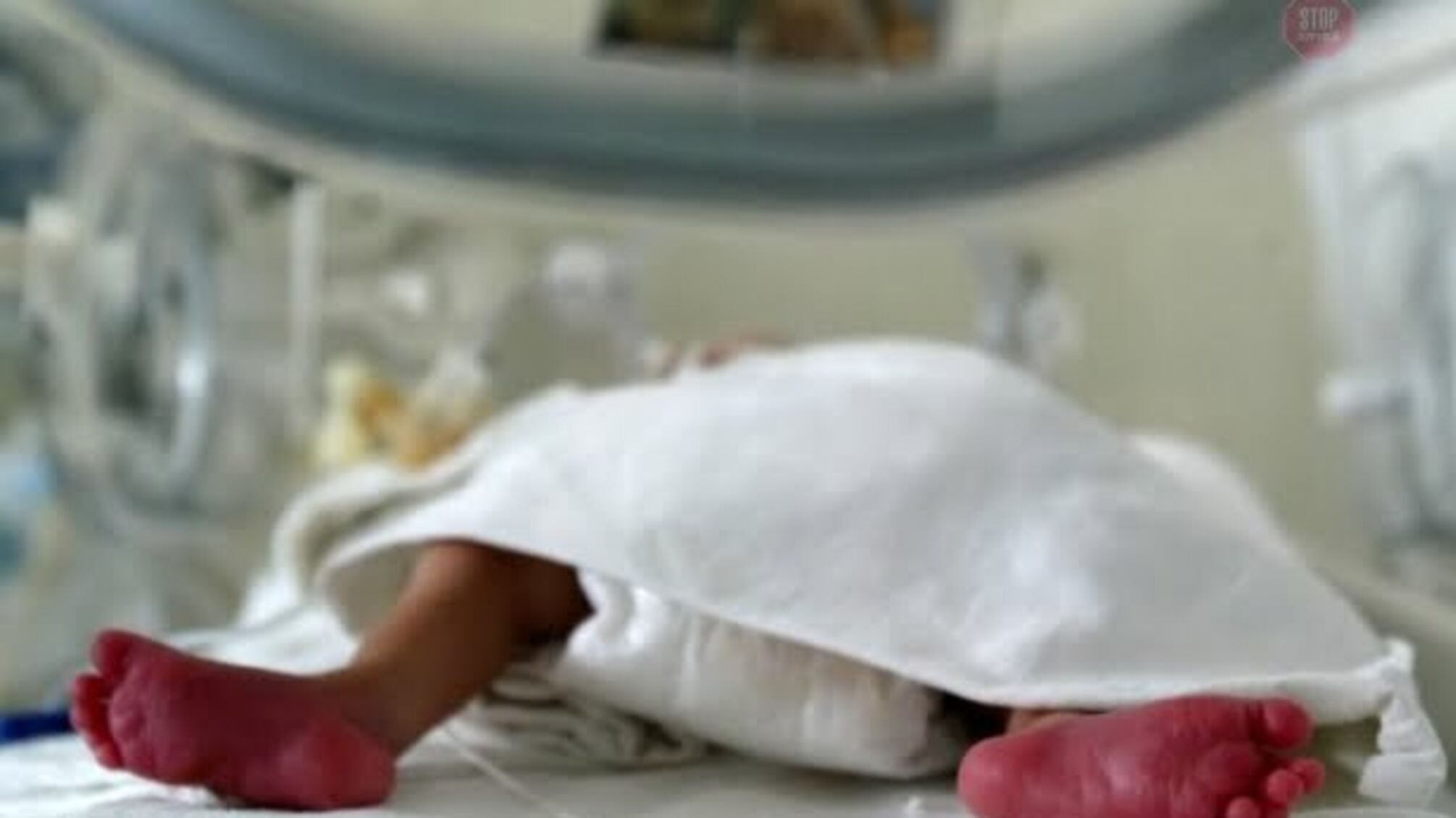 Помирали на самоті: подробиці трагедії новонароджених сіамських близнючок у Чернівцях