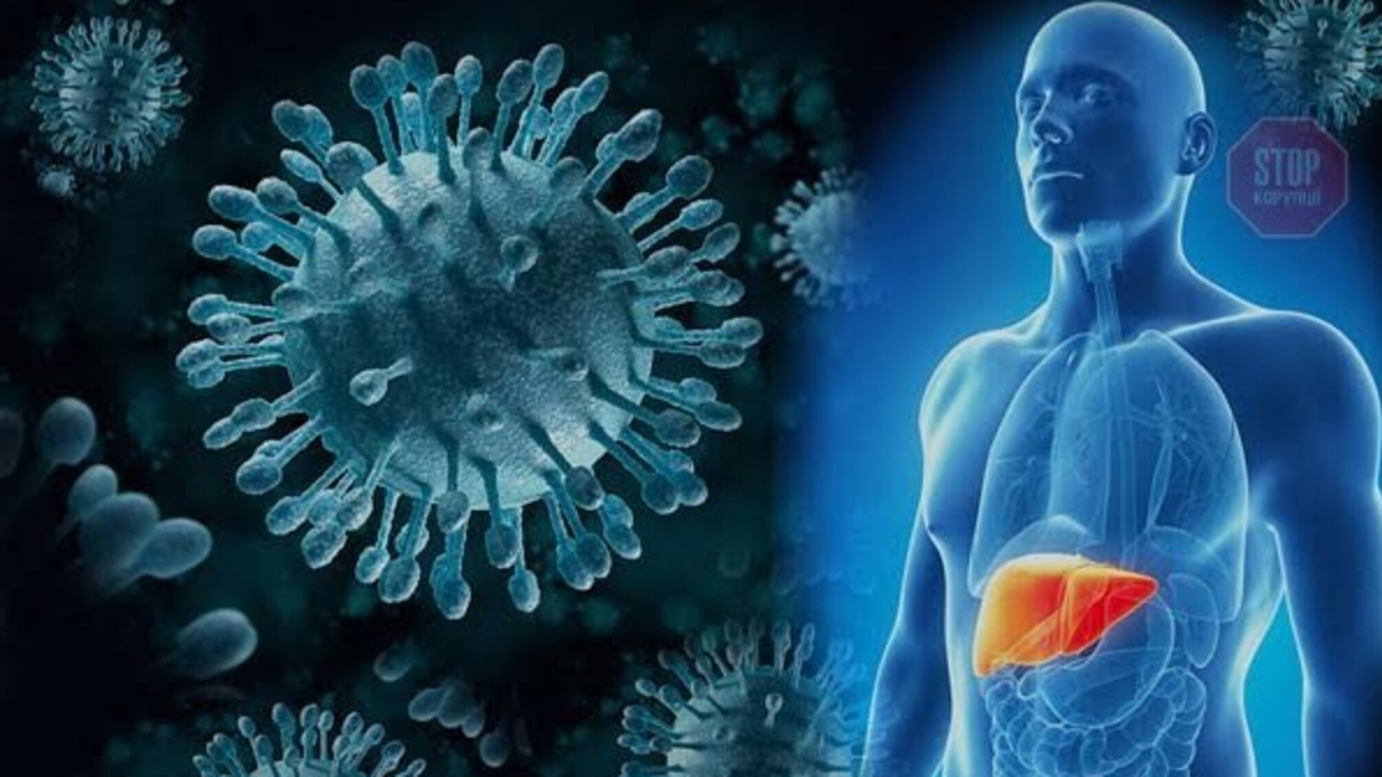 Спалах 'гепатиту А' в Чернігові: дітей могла заразити працівниця їдальні