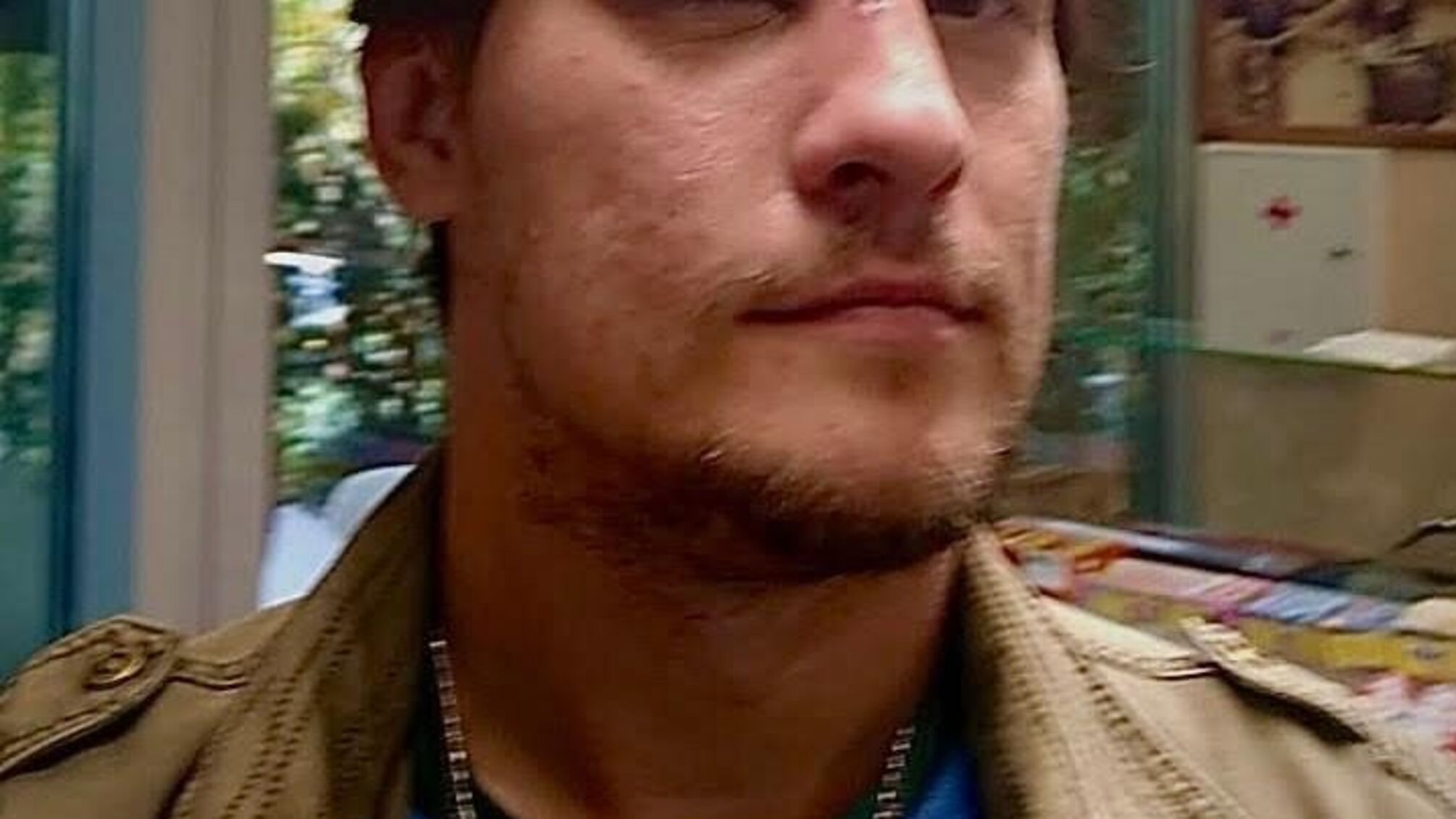 Троє на одного: у столиці побили активіста, який виступає проти незаконної забудови на Платонівському (фото)