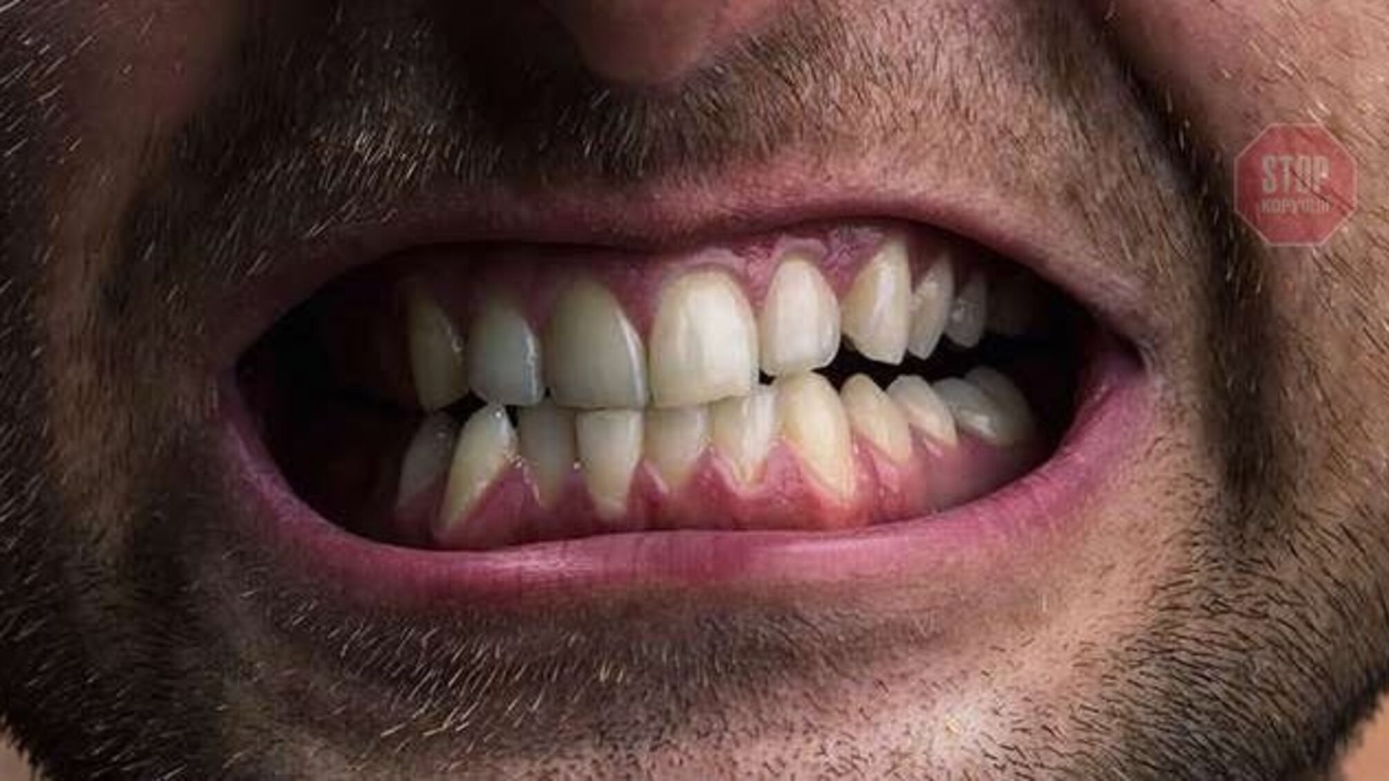 Викрадач покусав господаря авто: в Маріуполі засудили нападника