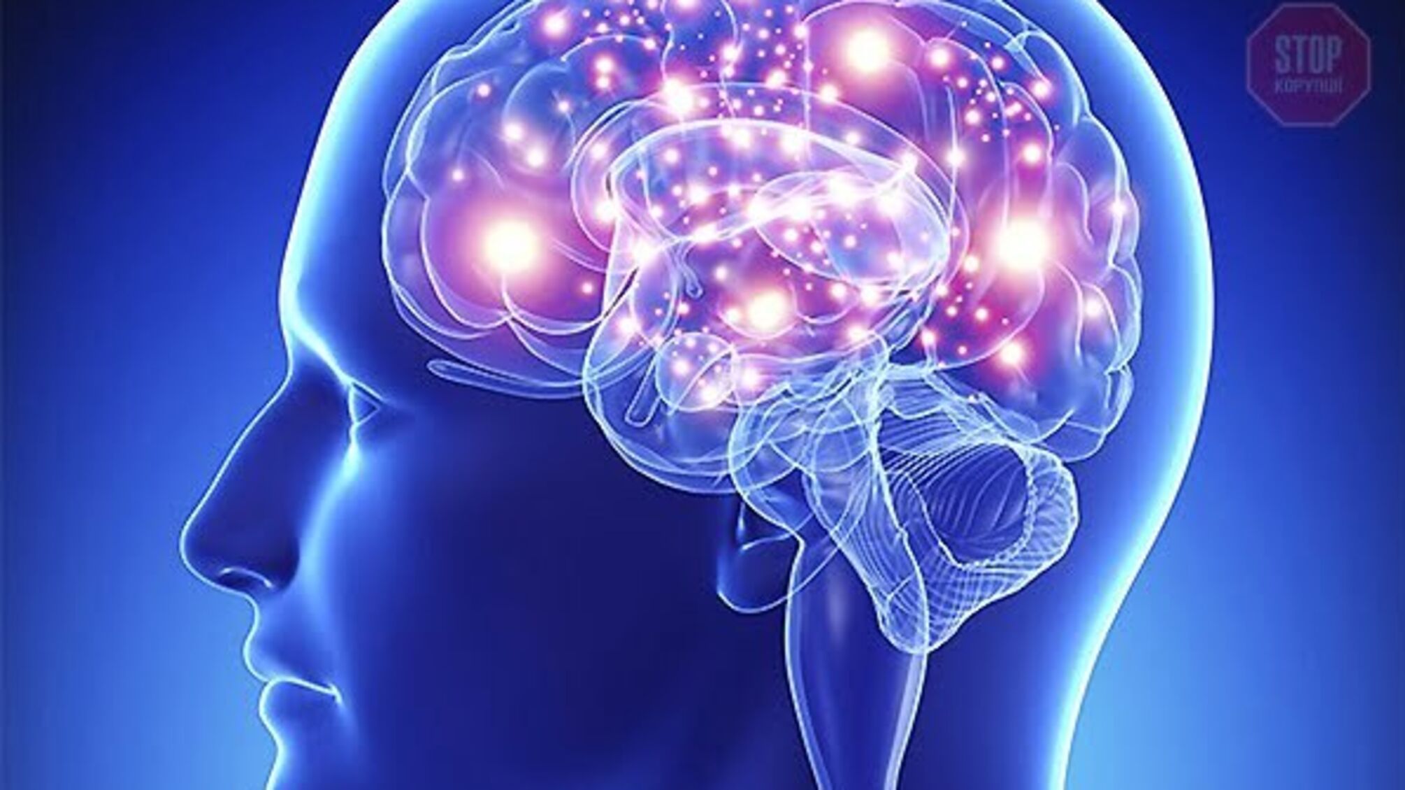 Унікальна операція на головному мозку: в Дніпрі боролися з новоутворенням скроневої кістки (фото)