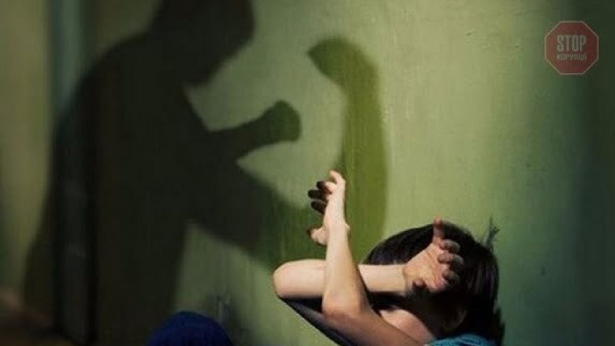 На Донеччині вітчим покалічив 9-річну дитину: у хлопчика перелом ребер (фото)