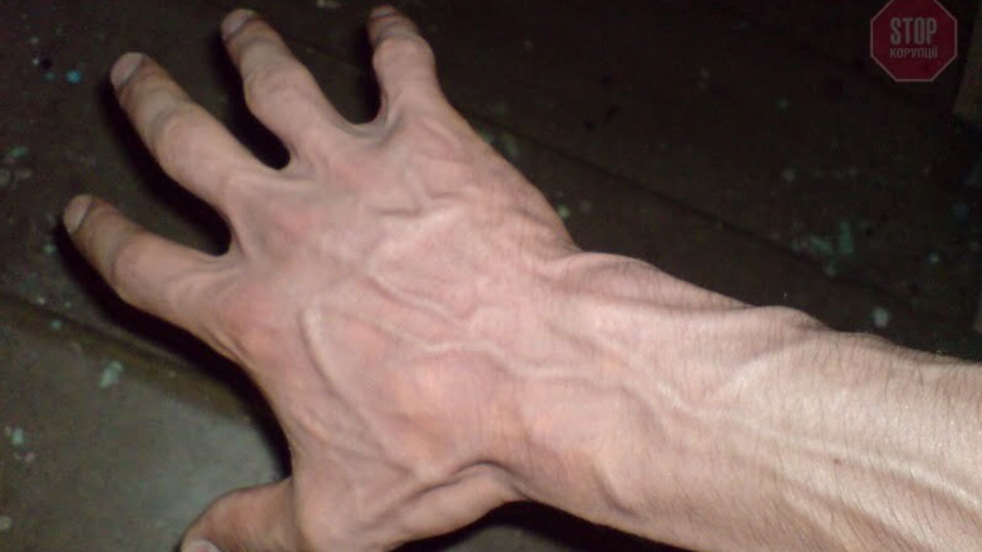 На Дніпропетровщині хлопець намагався покінчити життя самогубством (фото 18+)