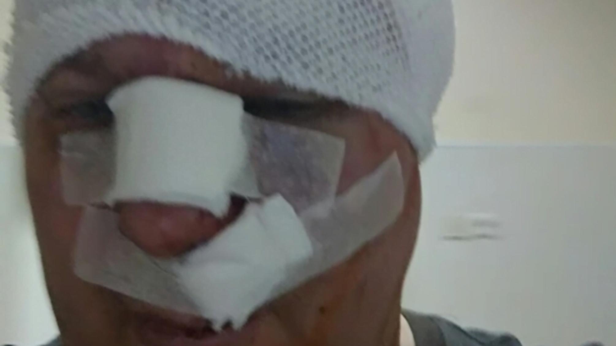 Захисники тварин? – У Києві жорстоко побили відомого догхантера (ФОТО)