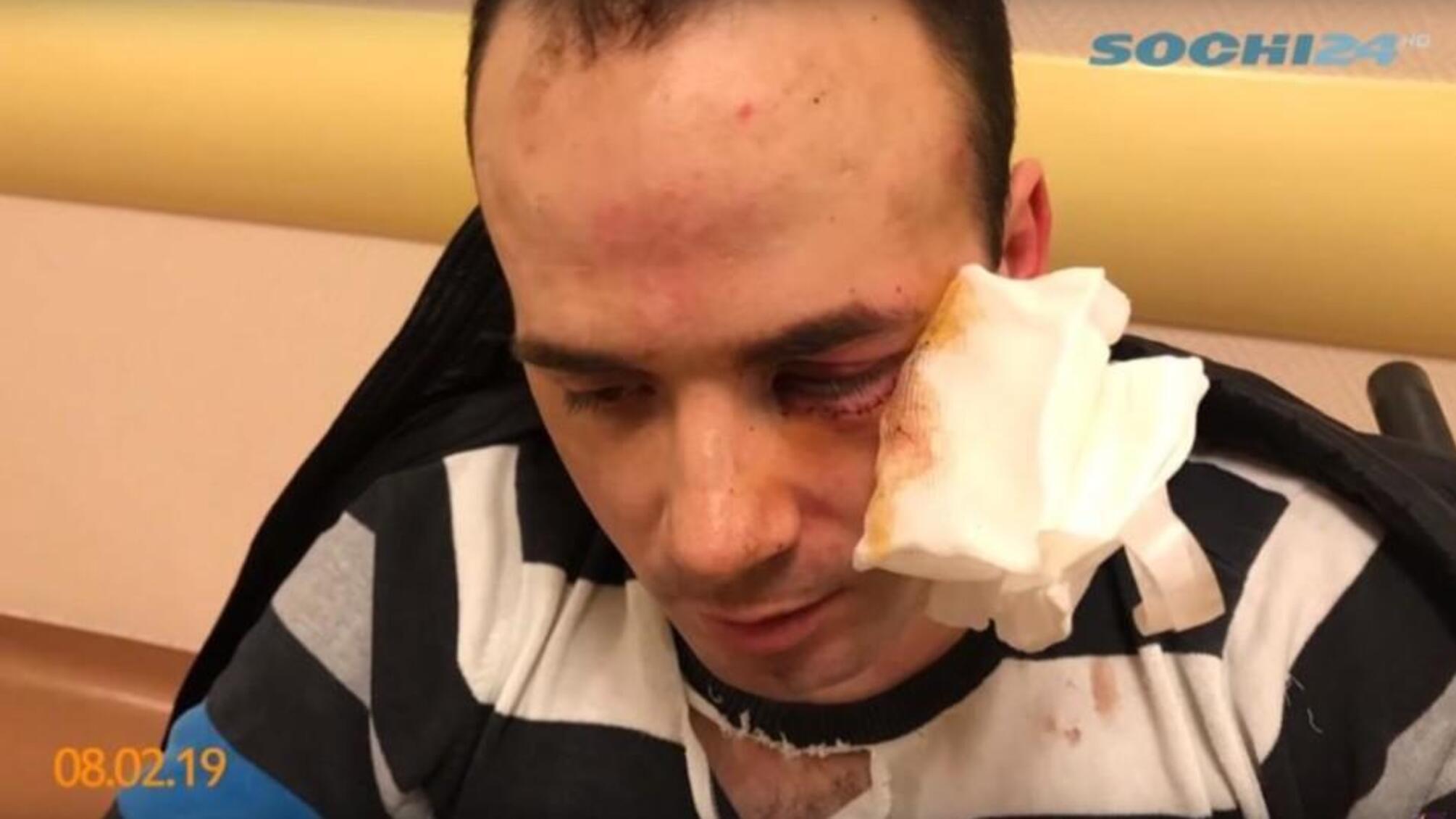 В Росії водій автомобіля сильно побив інваліда без ніг (ВІДЕО)