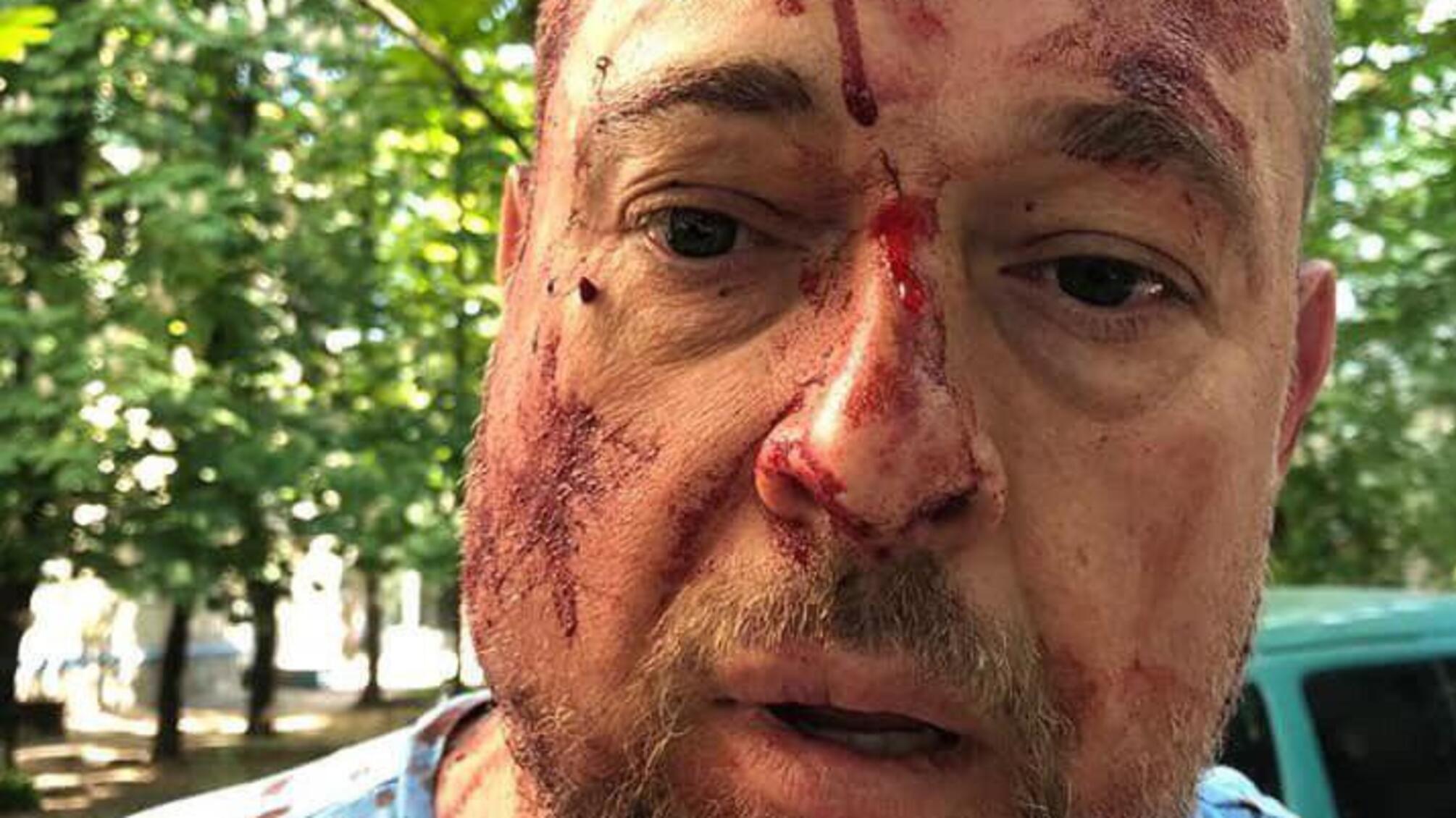 У Харкові сильно побили активіста Нацкорпусу (ФОТО)