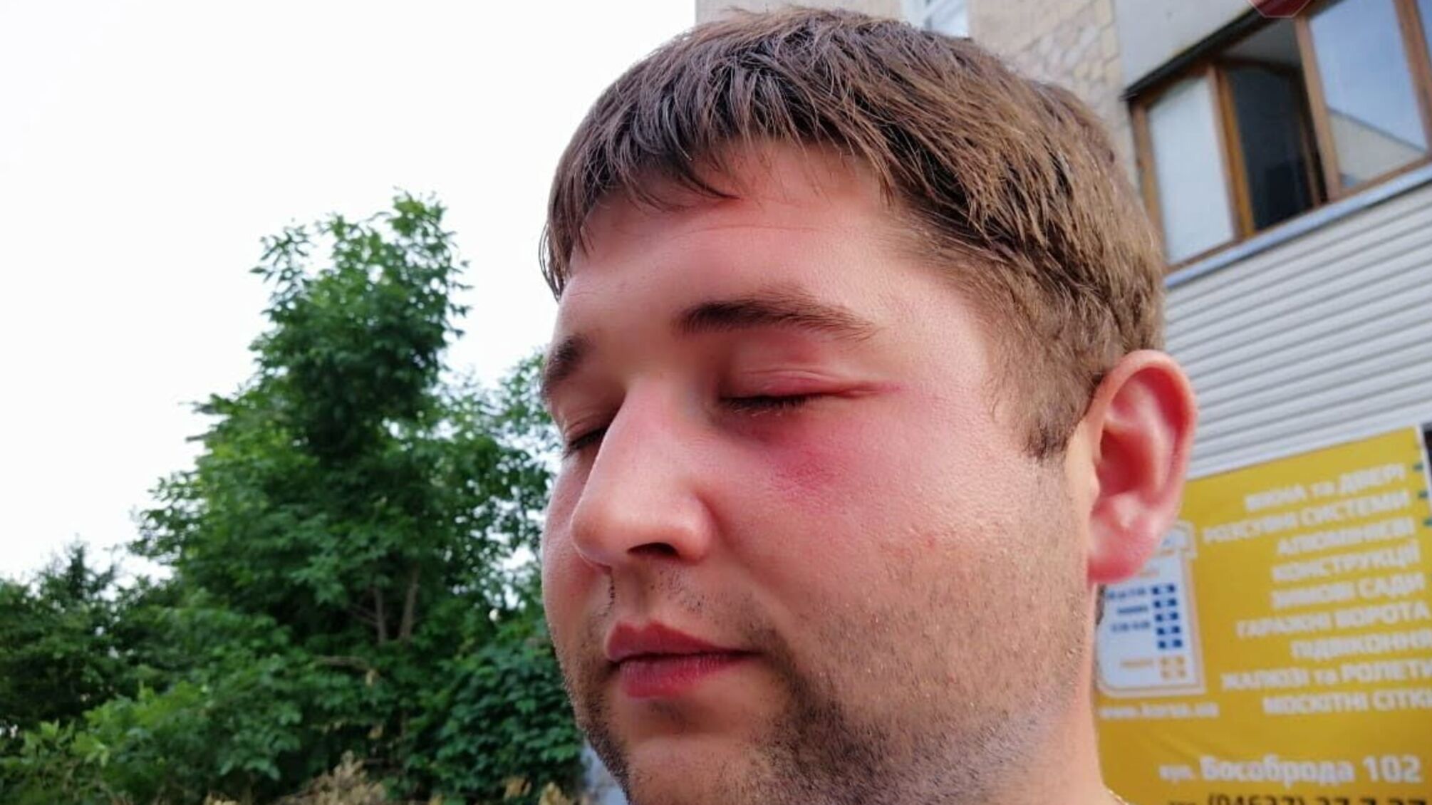 'Розраховуємо на миттєву реакцію правоохоронців': у НСЖУ занепокоєні через напад на 'СтопКор' у Прилуках