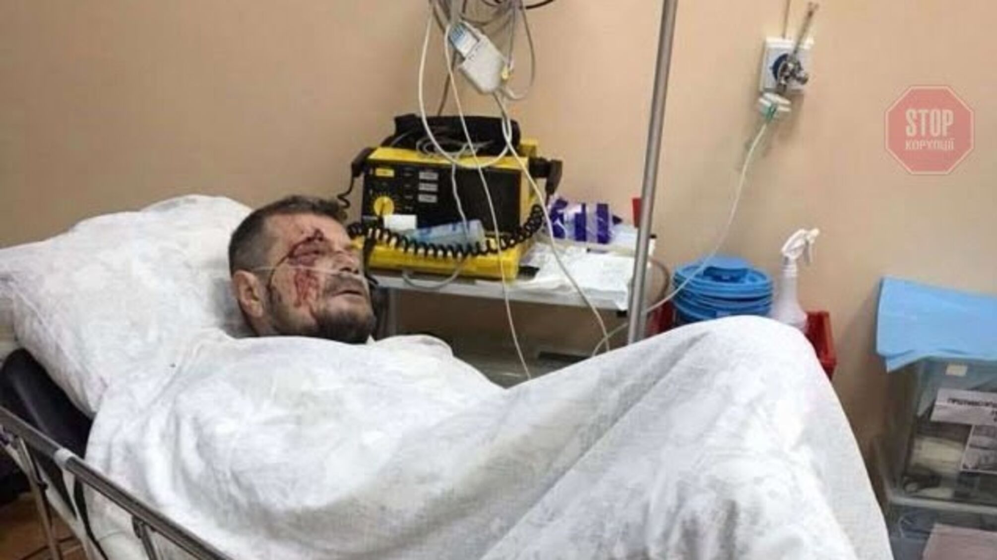 Відомий екснардеп залишається під охороною СБУ