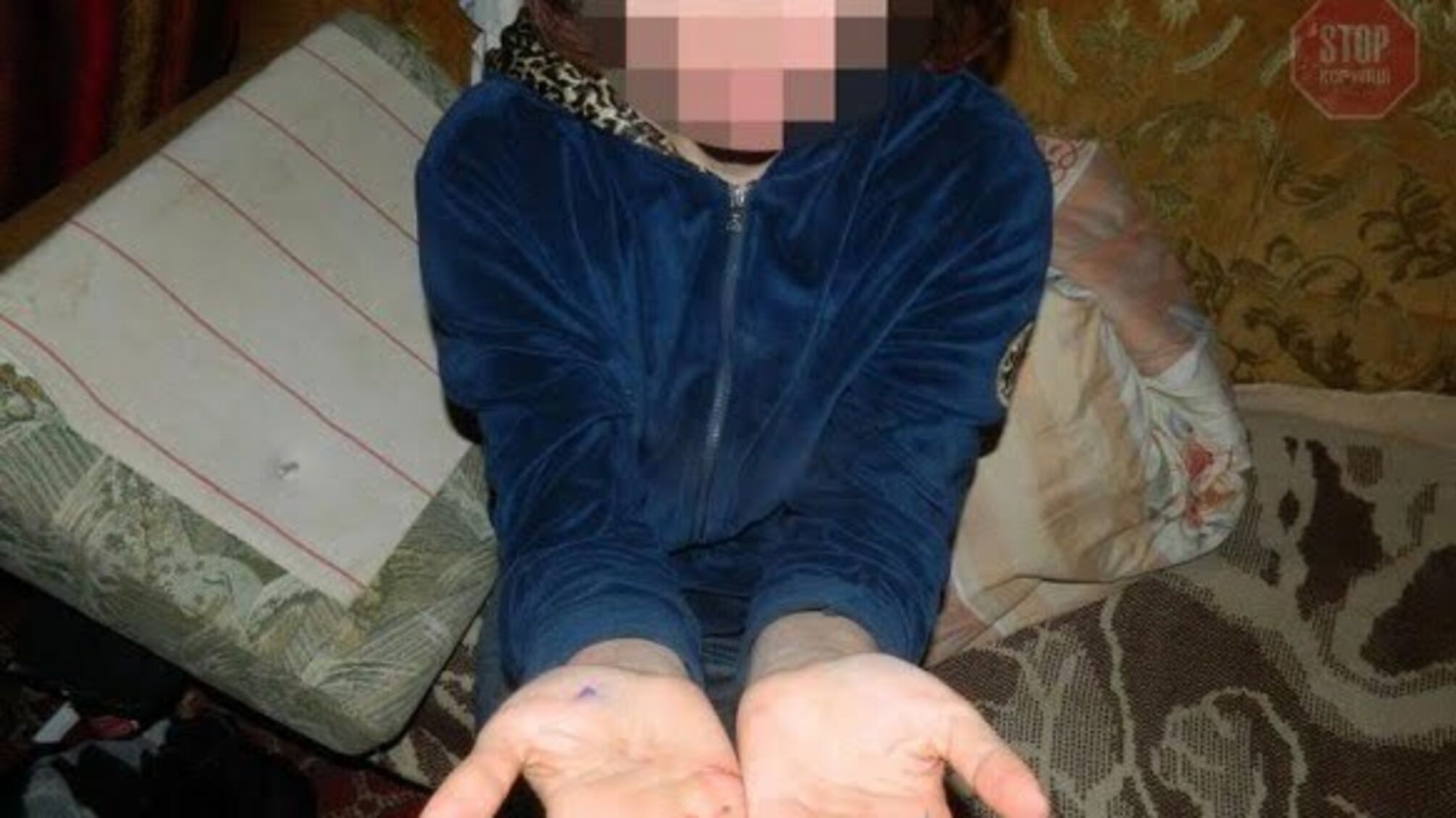 Сімейний конфлікт: у Києві жінка порізала ножем брата, який облив окропом матір