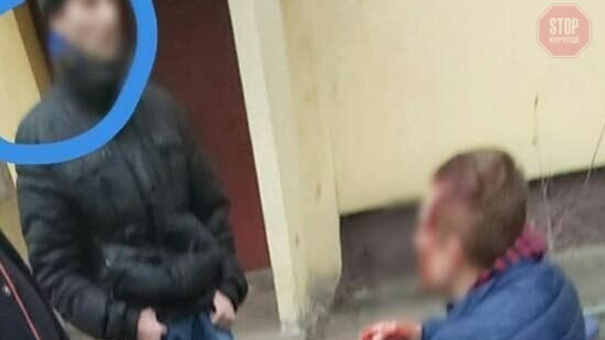 У Кременчуці чоловік побив неуважного власника собаки металевою трубою (фото)