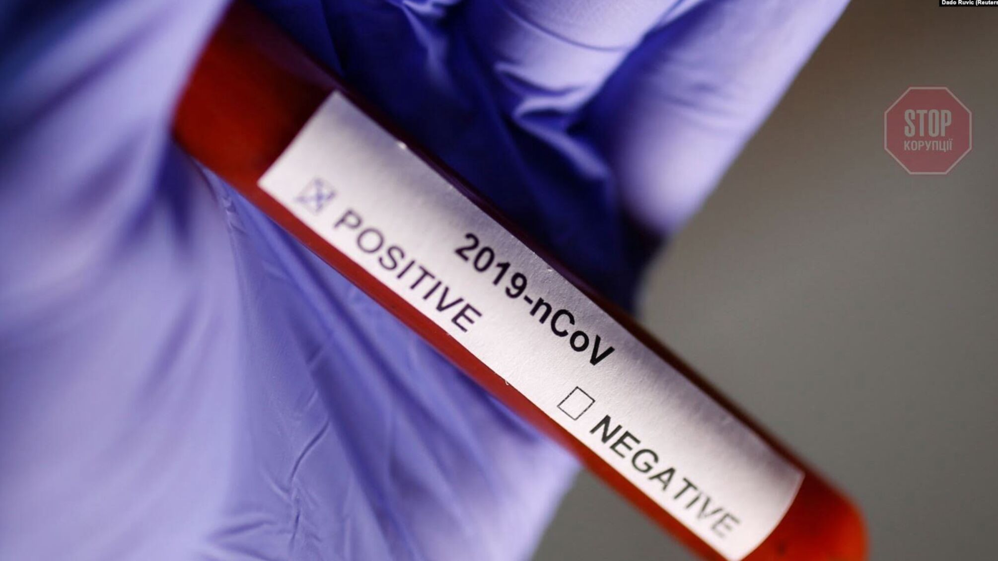 У Франції госпіталізували п’яту жертву китайського коронавірусу