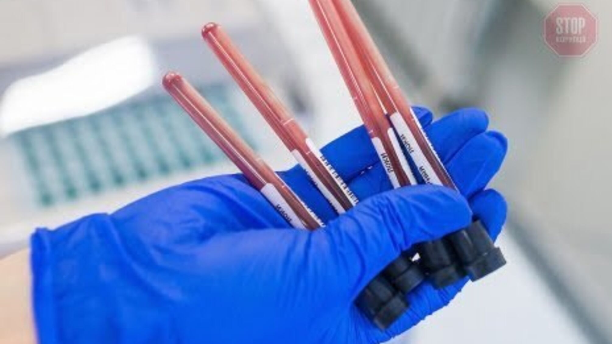 Одразу госпіталізували: у Львові студента, прибулого з Китаю, залишили в лікарні