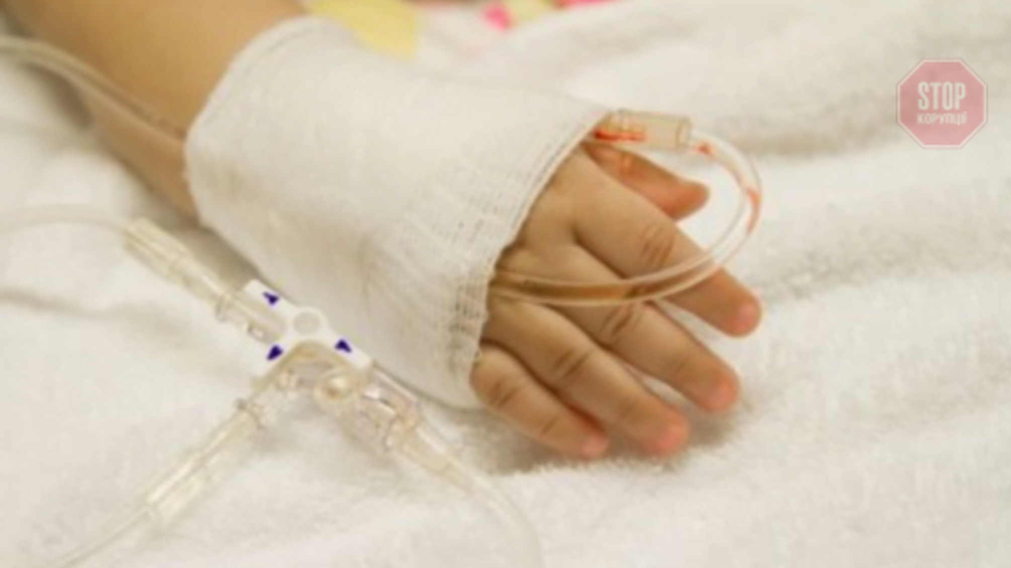 Обпікся окропом: на Одещині рятують однорічного малюка