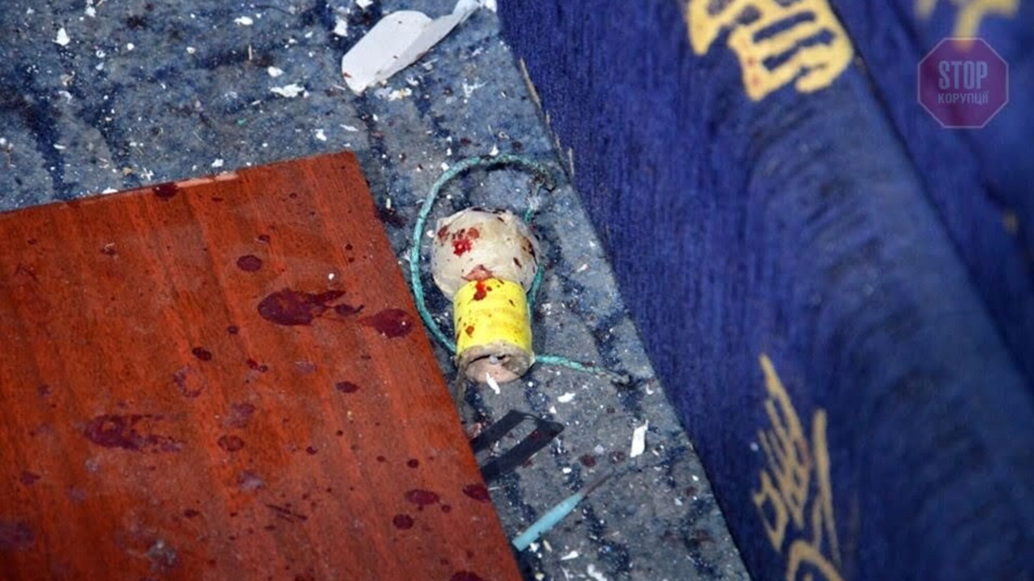 Небезпечні ігри: у Дніпрі дівчина загинула від вибуху саморобної петарди (фото)